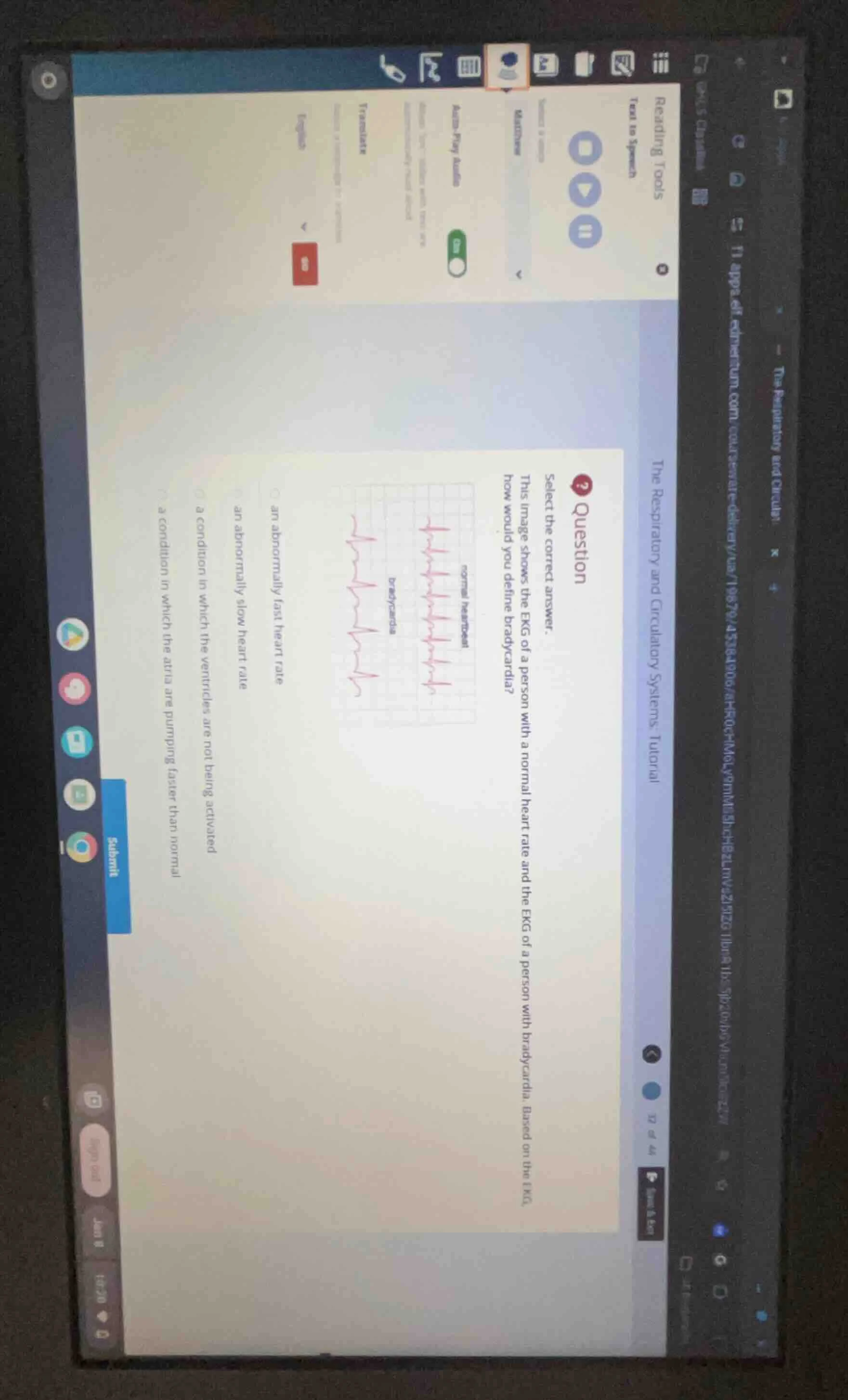 question select the correct answer. this image shows the ekg of a perso…