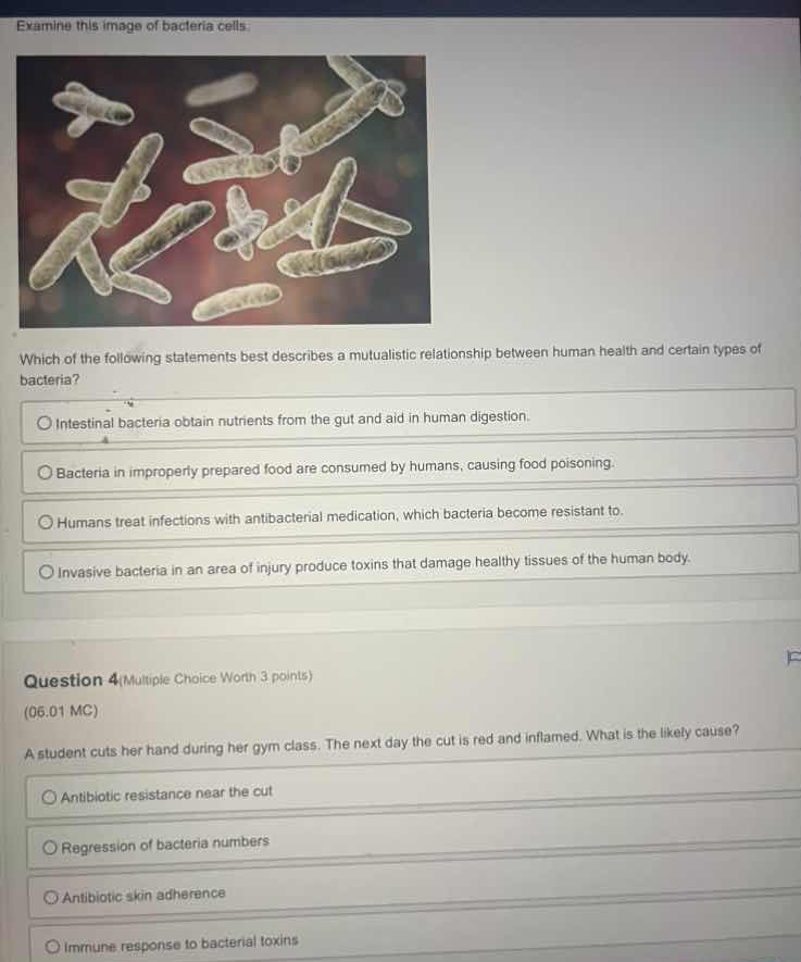 examine this image of bacteria cells. which of the following statements…