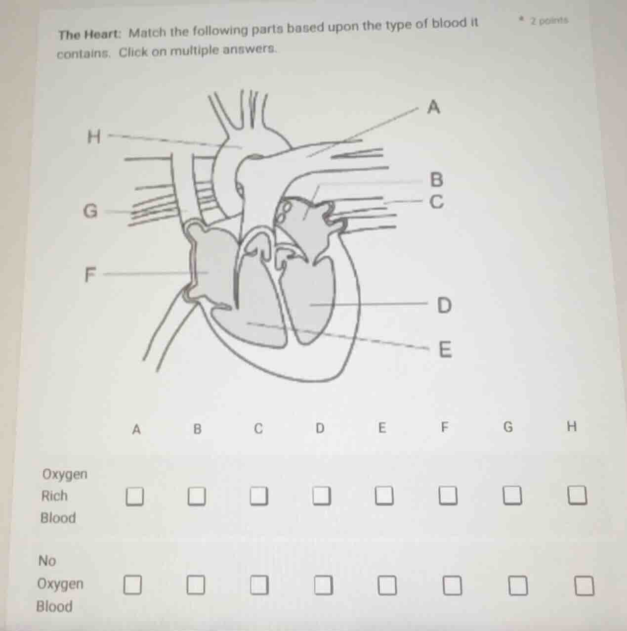 the heart: match the following parts based upon the type of blood it co…