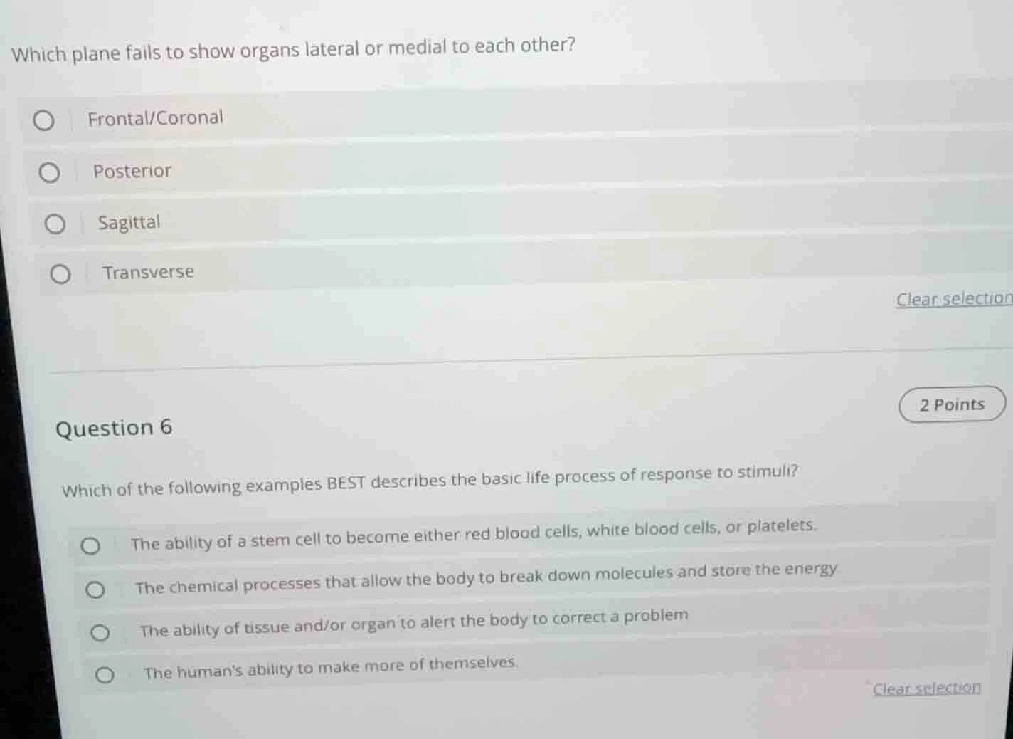 which plane fails to show organs lateral or medial to each other? front…
