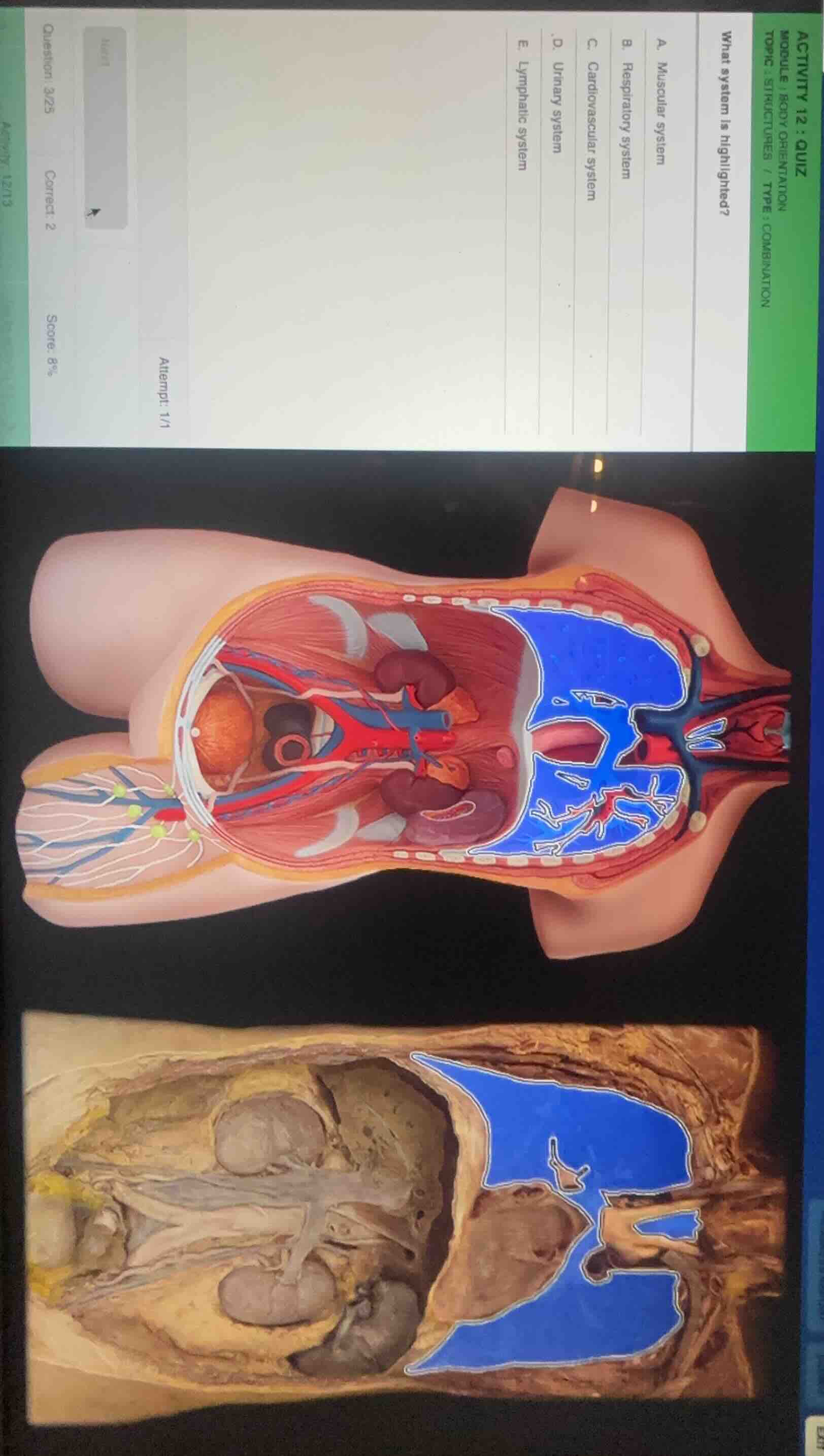 activity 12 : quiz module : body orientation topic : structures / type …