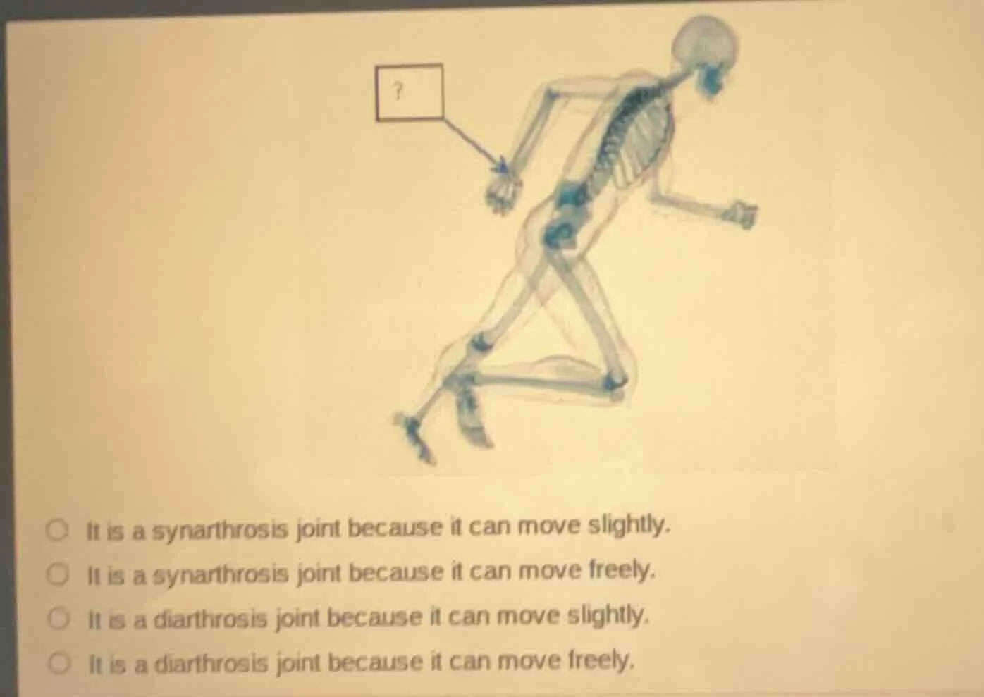 it is a synarthrosis joint because it can move slightly. it is a synart…