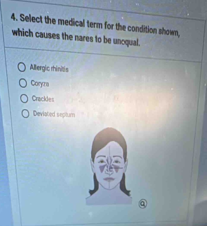 4. select the medical term for the condition shown, which causes the na…