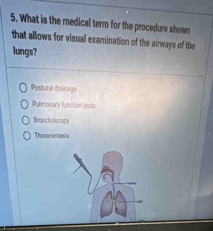 5. what is the medical term for the procedure shown that allows for vis…