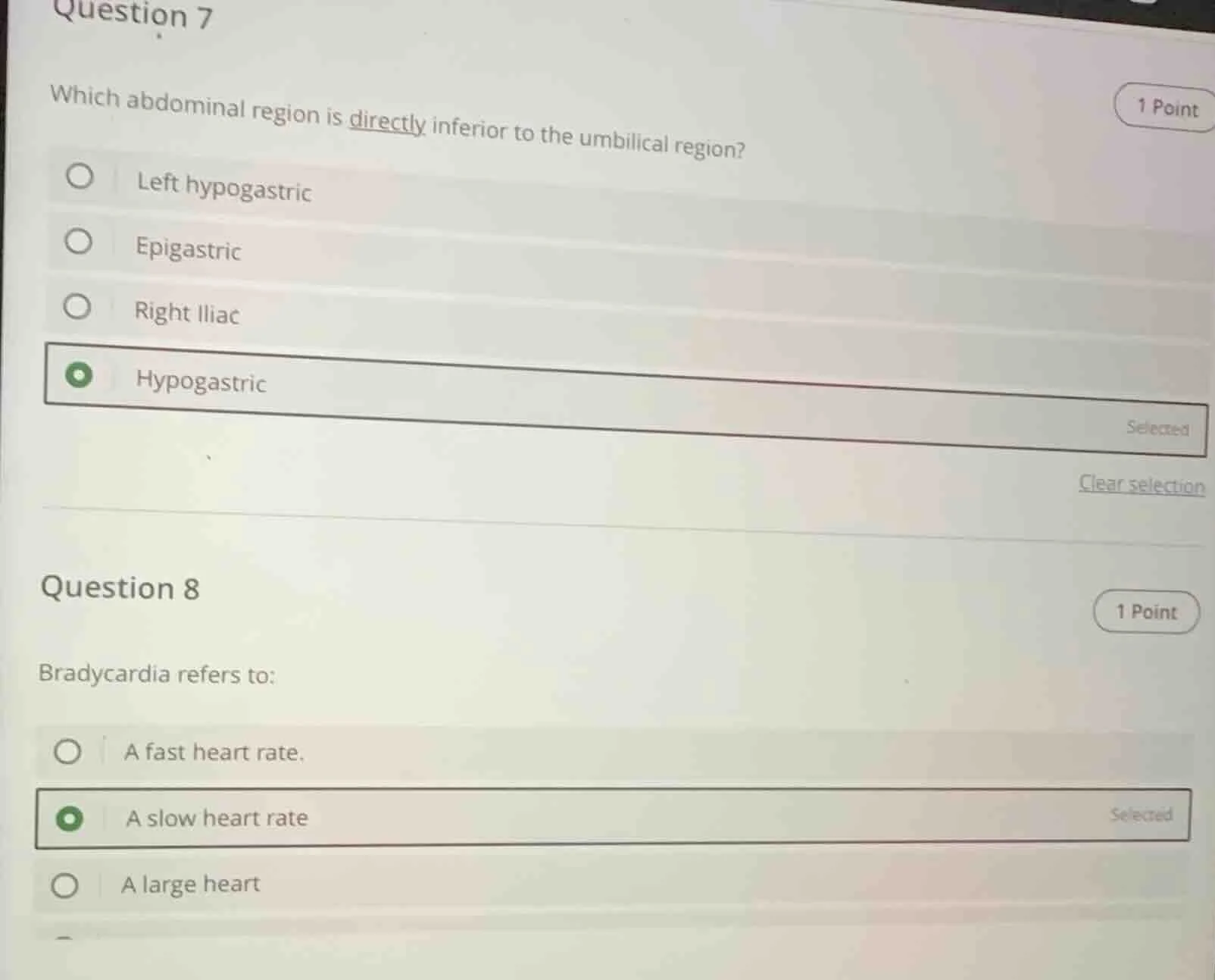 question 7 which abdominal region is directly inferior to the umbilical…