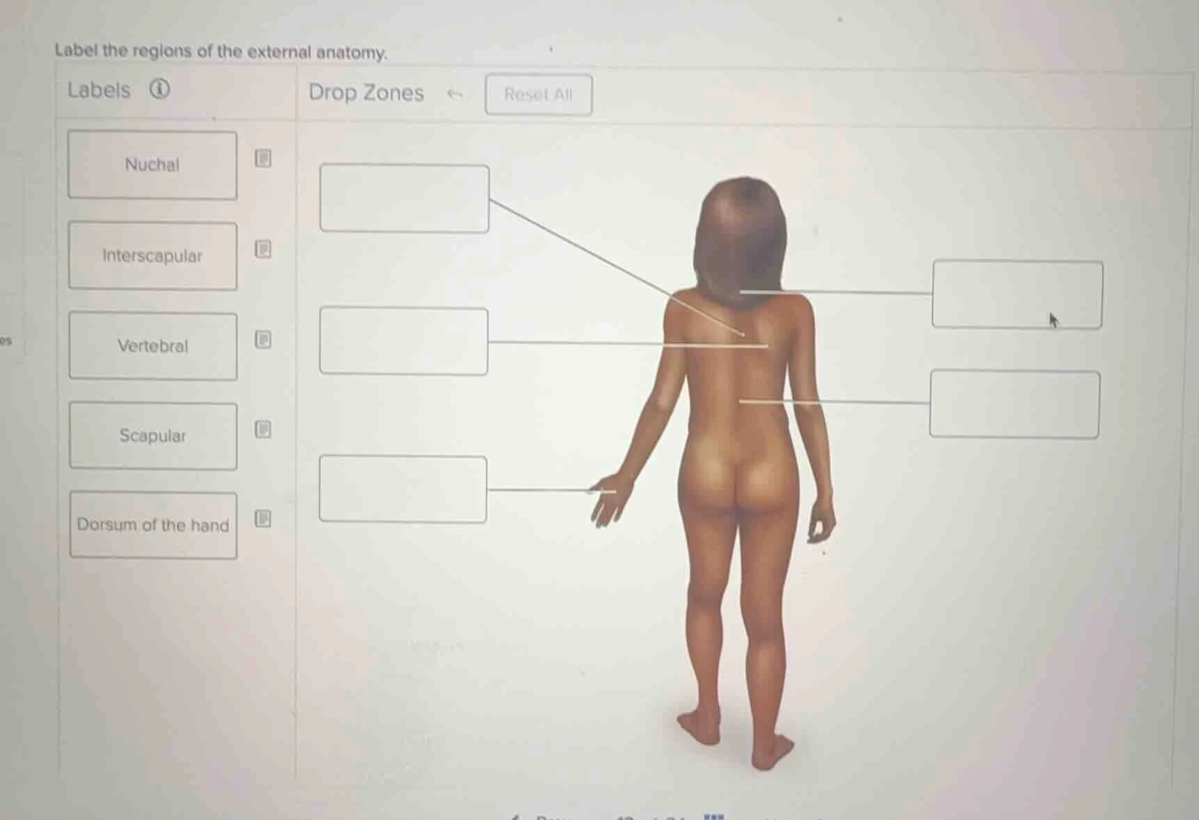 label the regions of the external anatomy. labels nuchal interscapular …