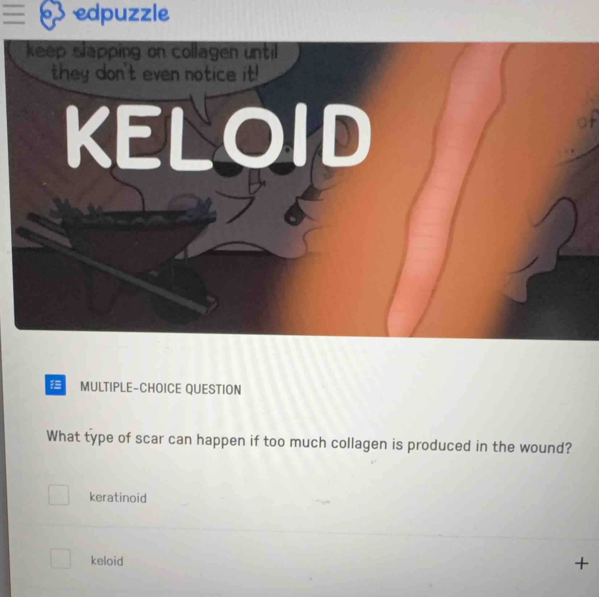 multiple-choice question what type of scar can happen if too much colla…