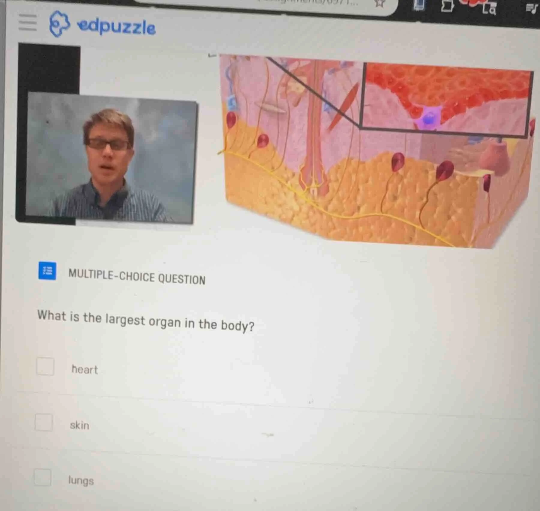 multiple-choice question what is the largest organ in the body? heart s…