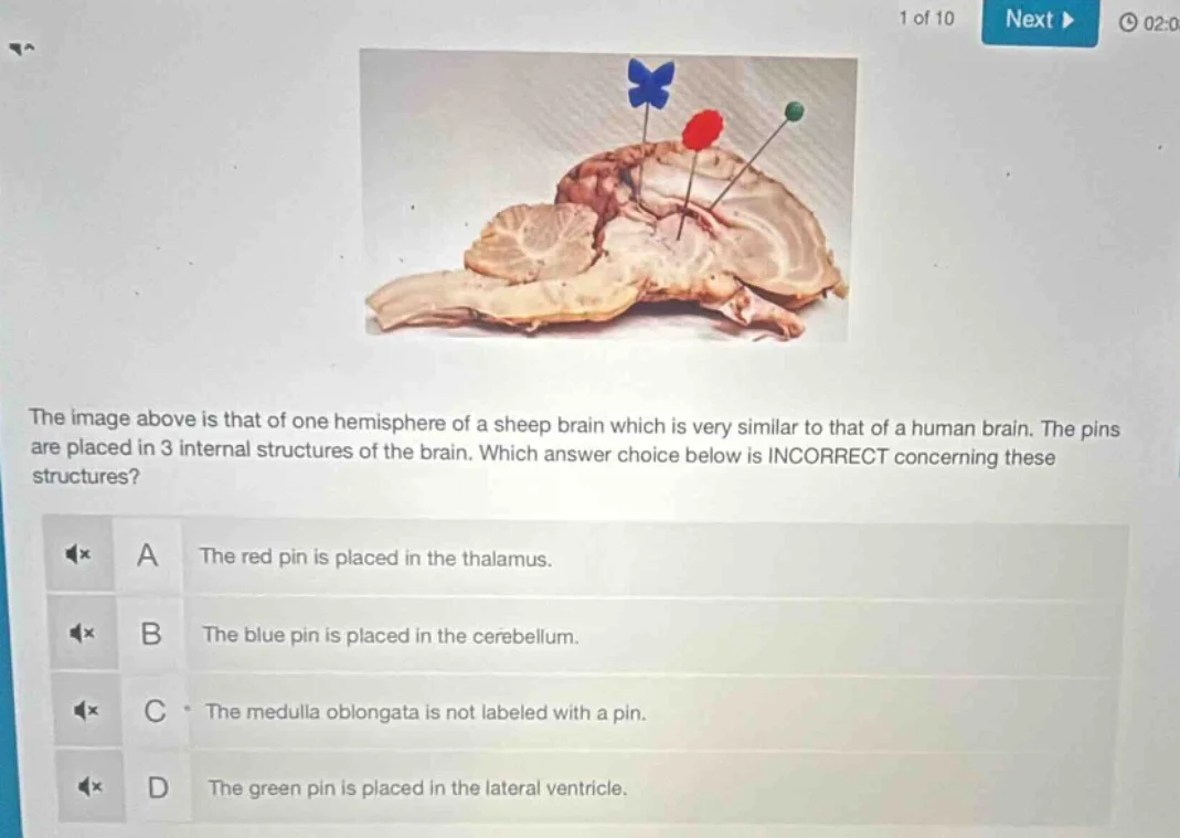 the image above is that of one hemisphere of a sheep brain which is ver…