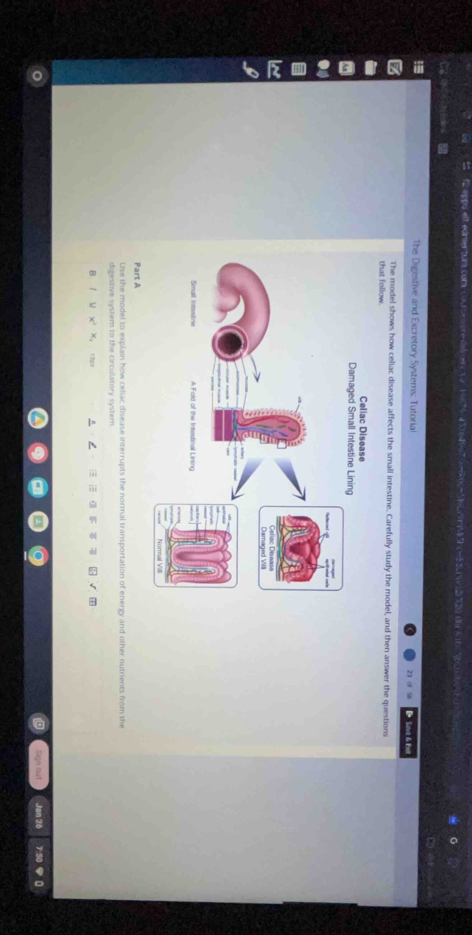 the digestive and excretory systems tutorial the model shows how celiac…