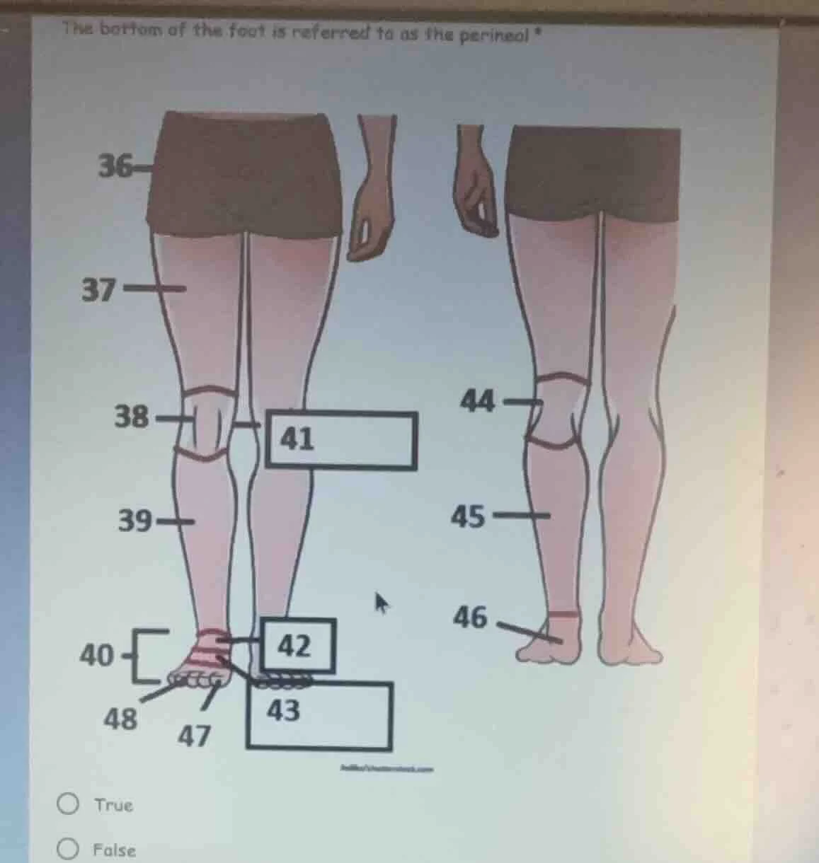 the bottom of the foot is referred to as the perineal? true false