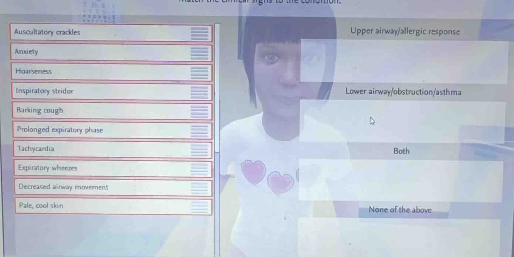 match the clinical signs to the condition. auscultatory crackles anxiet…