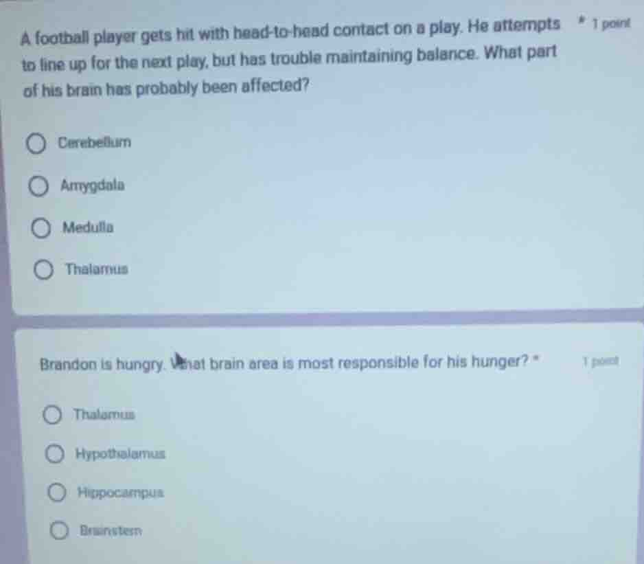 a football player gets hit with head - to - head contact on a play. he …