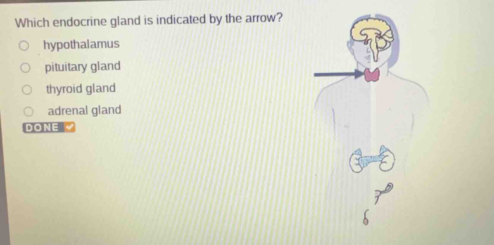 which endocrine gland is indicated by the arrow? hypothalamus pituitary…