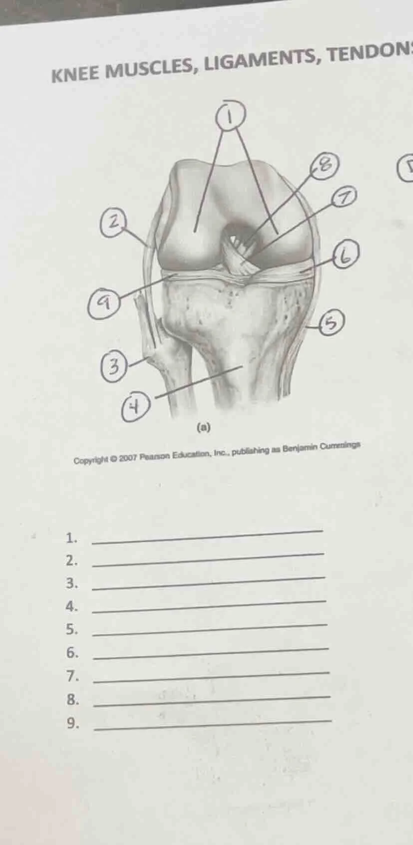 knee muscles, ligaments, tendon (a) copyright © 2007 pearson education,…