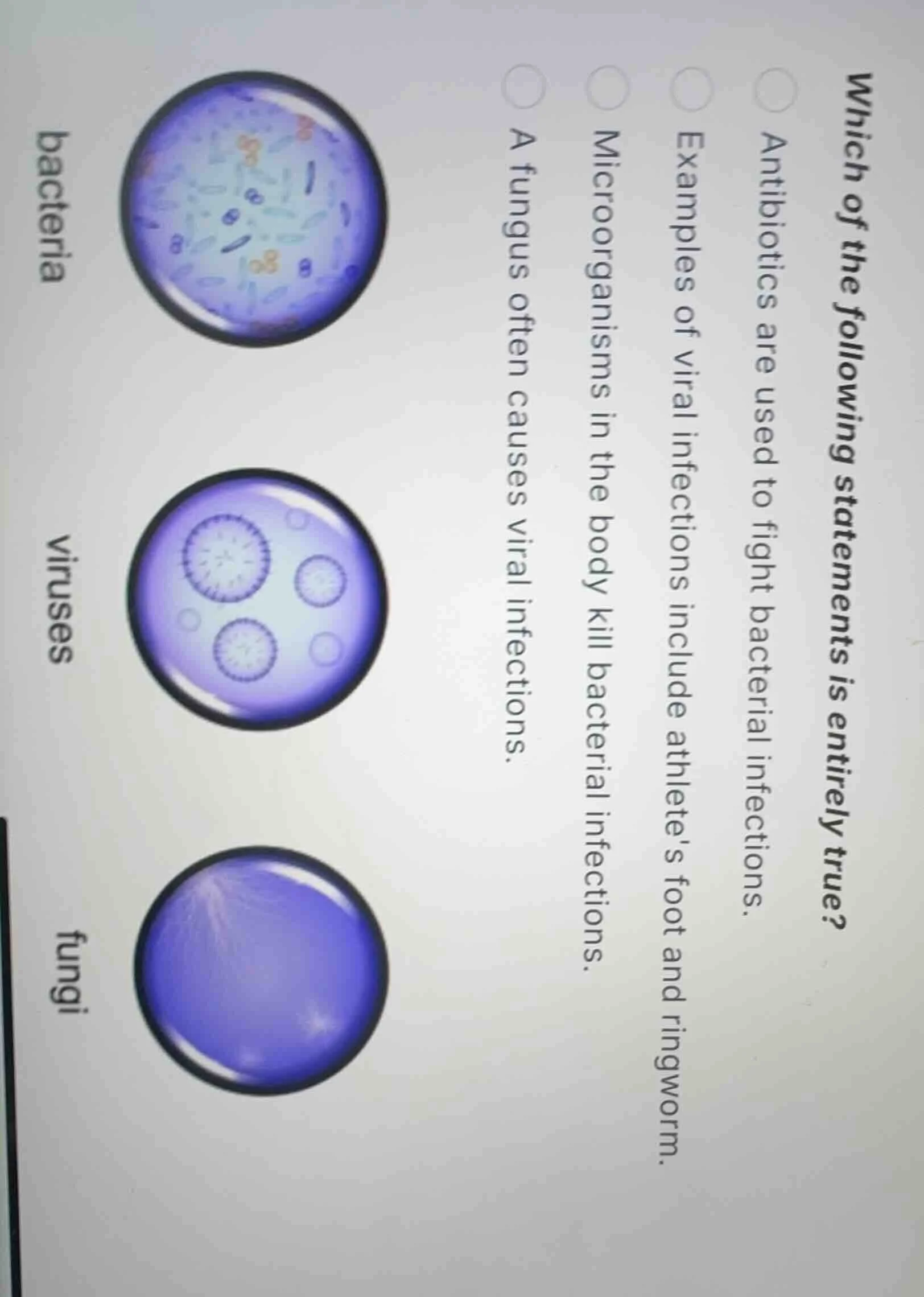 which of the following statements is entirely true? antibiotics are use…