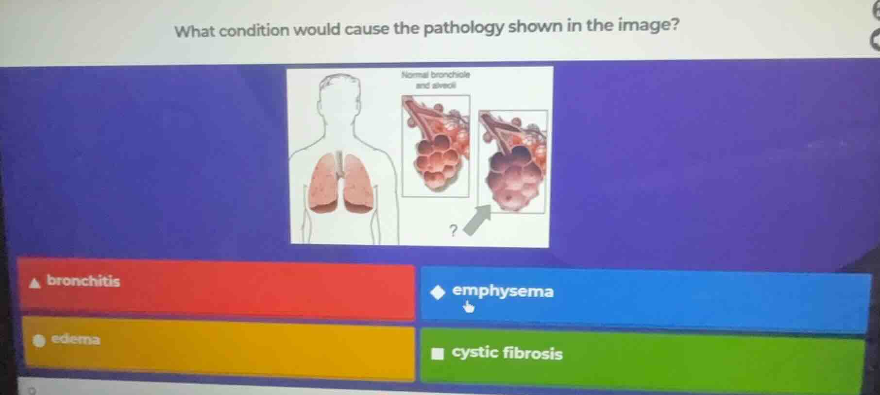 what condition would cause the pathology shown in the image?bronchitis …
