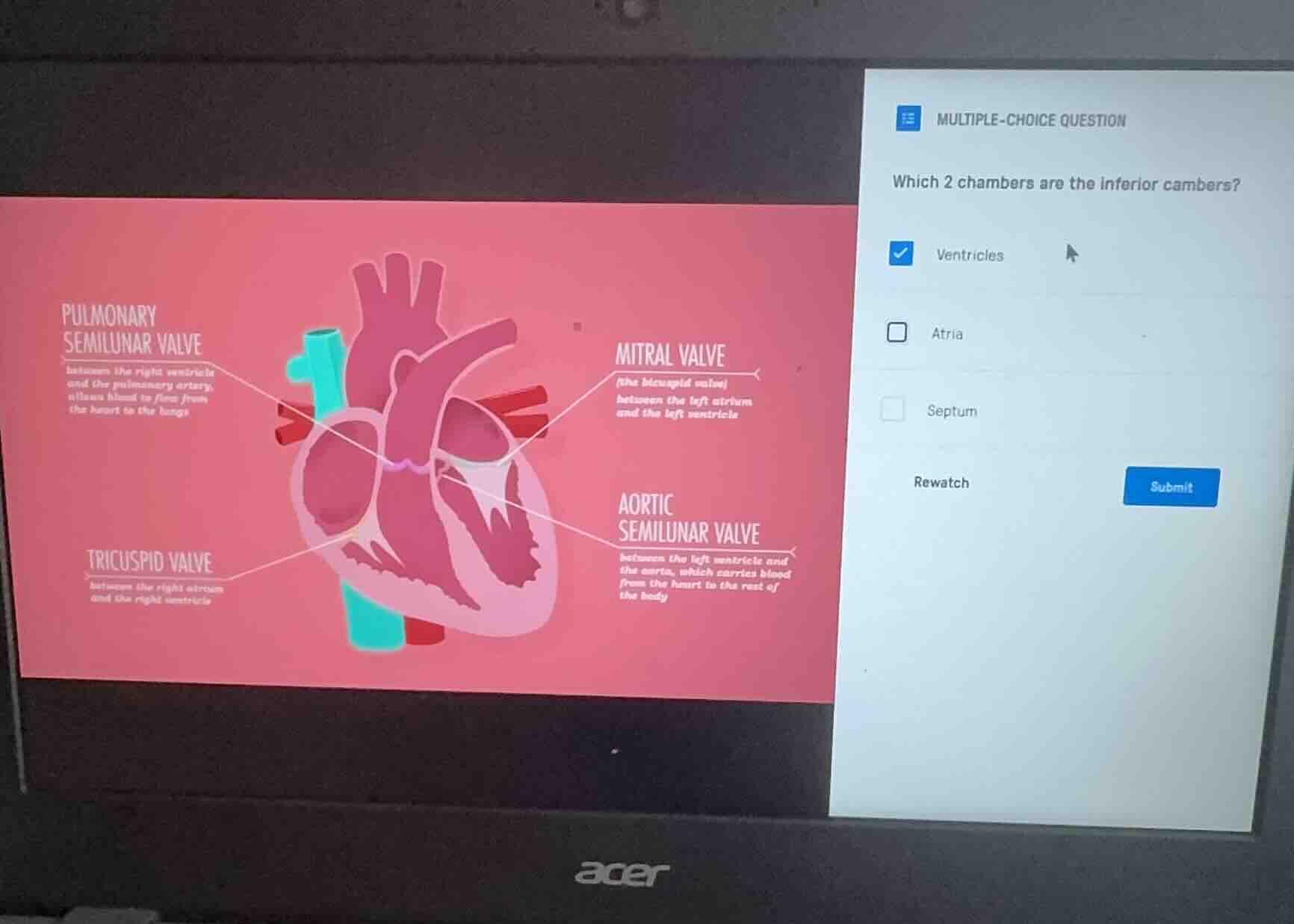 multiple-choice question which 2 chambers are the inferior cambers? ven…