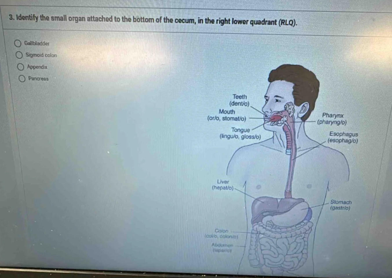 3. identify the small organ attached to the bottom of the cecum, in the…