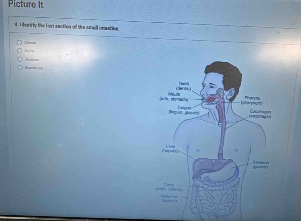 picture it 4. identify the last section of the small intestine. cecum i…