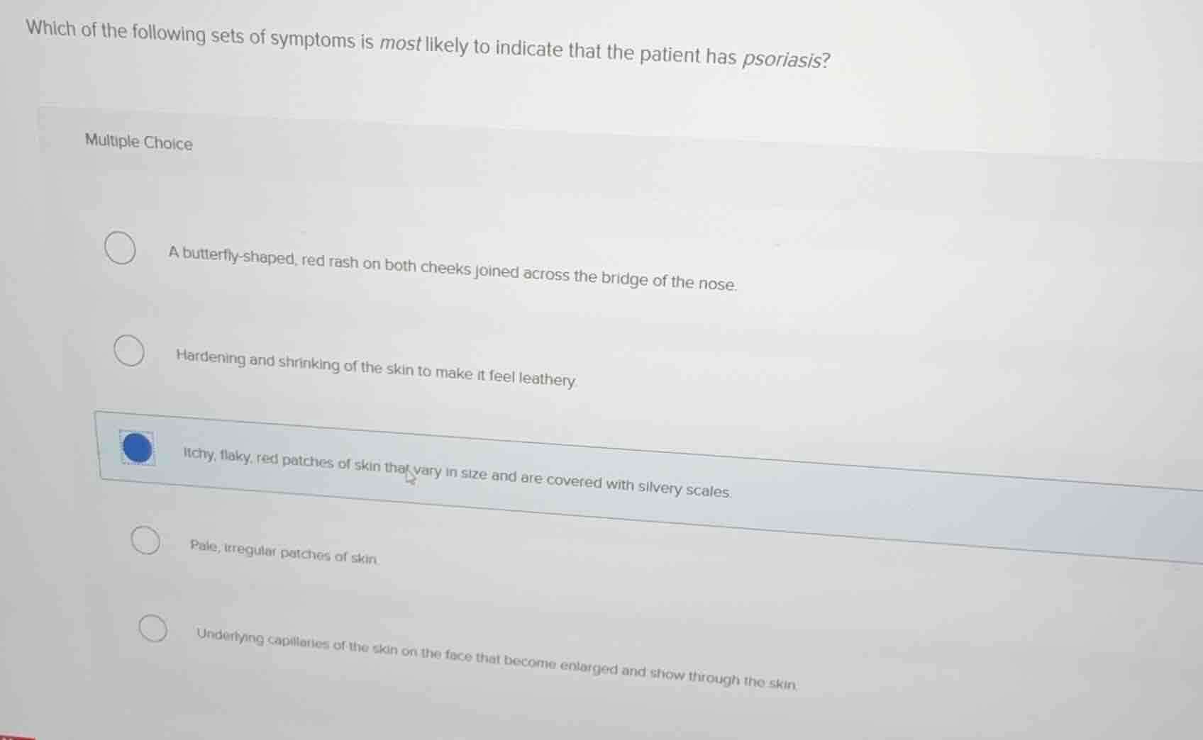 which of the following sets of symptoms is most likely to indicate that…