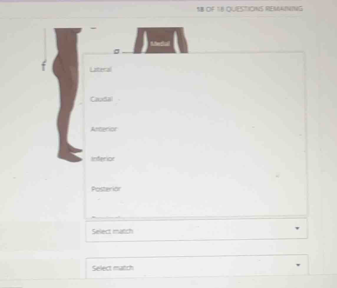 lateral\ caudal\ anterior\ inferior\ posterior\ select match\ select ma…