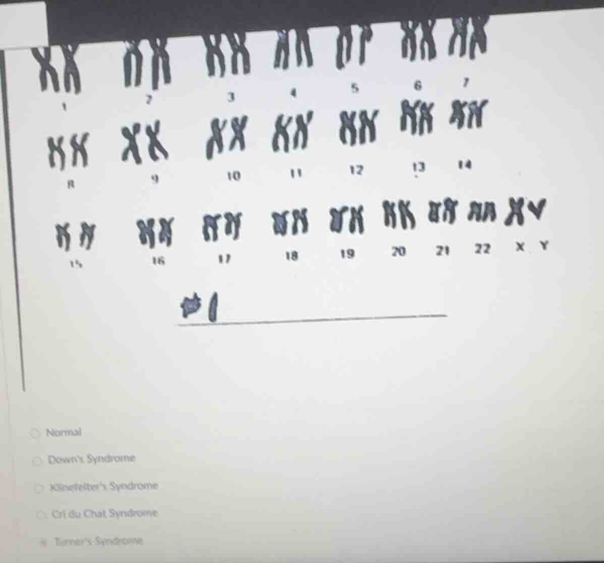 1 2 3 4 5 6 7 8 9 10 11 12 13 14 15 16 17 18 19 20 21 22 x y #1normaldo…