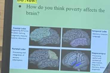 do now: • how do you think poverty affects the brain? frontal lobe: org…