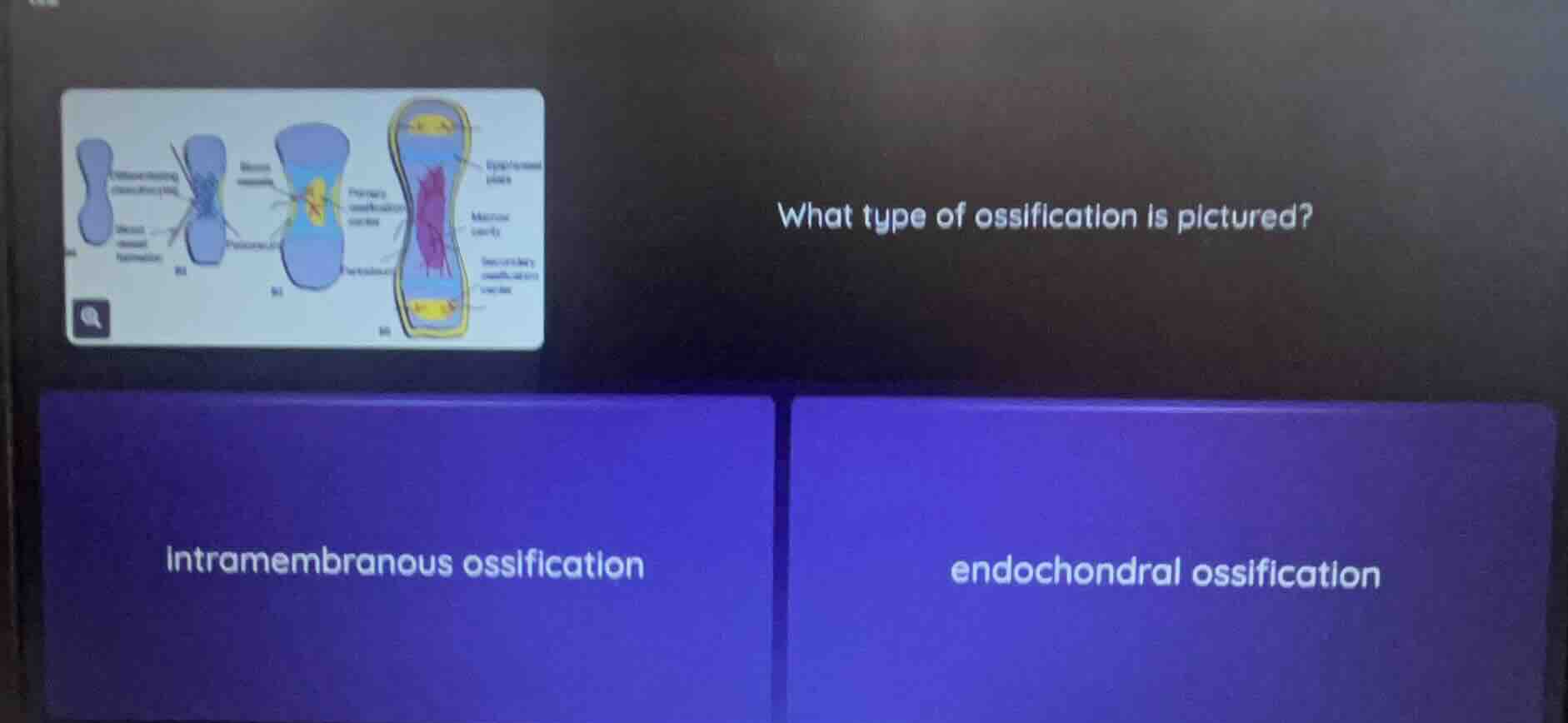 what type of ossification is pictured? intramembranous ossification end…