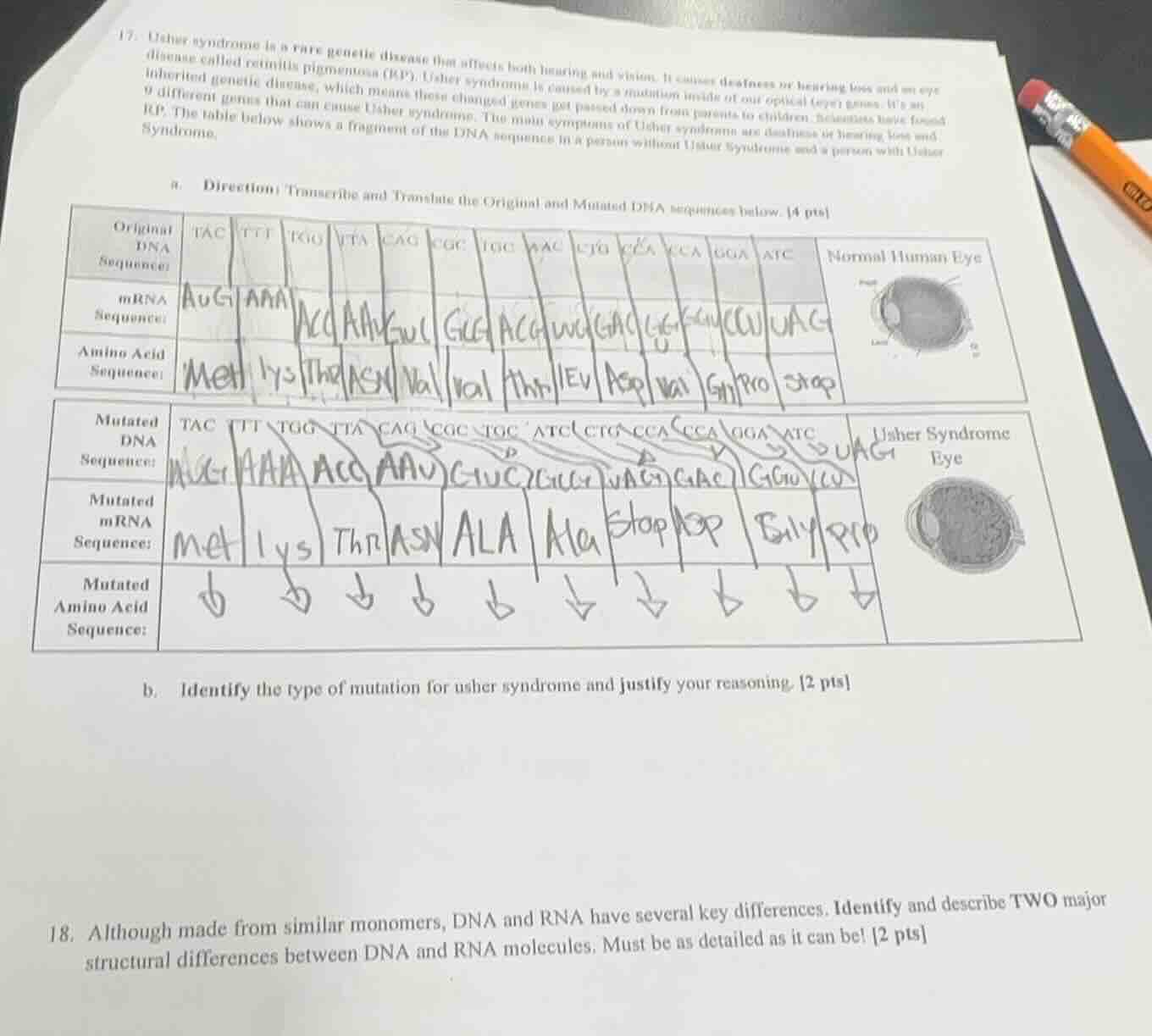 17. usher syndrome is a rare genetic disease that affects both hearing …