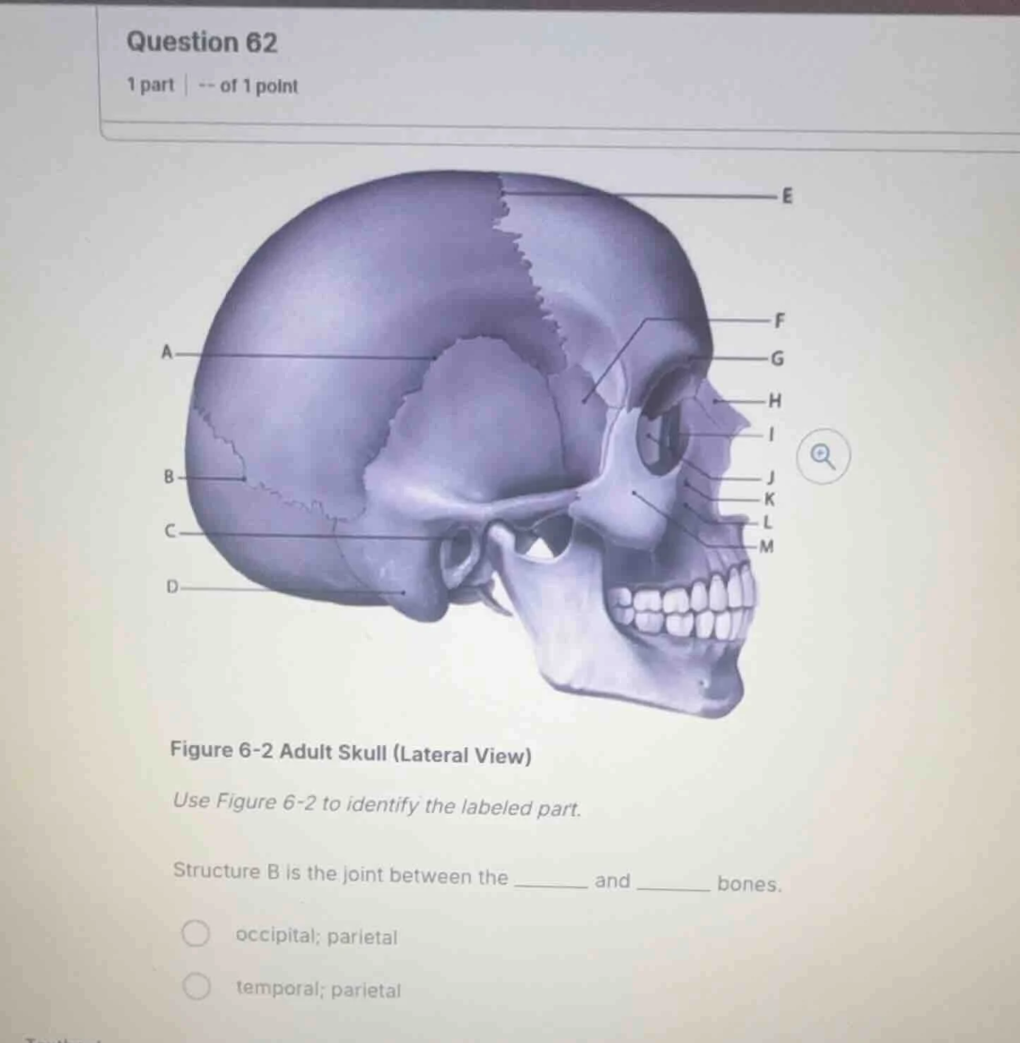 question 62 1 part | -- of 1 point figure 6-2 adult skull (lateral view…