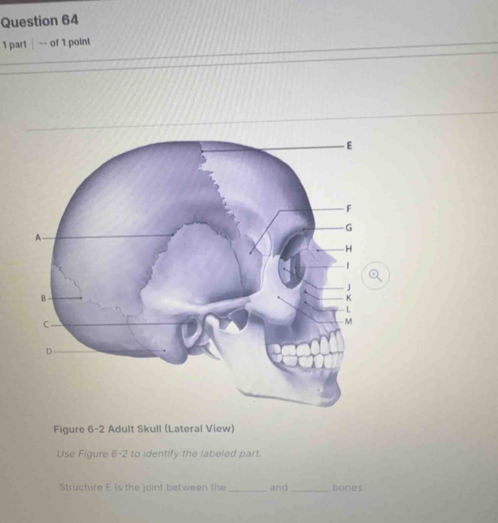 question 64 1 part | -- of 1 point figure 6-2 adult skull (lateral view…