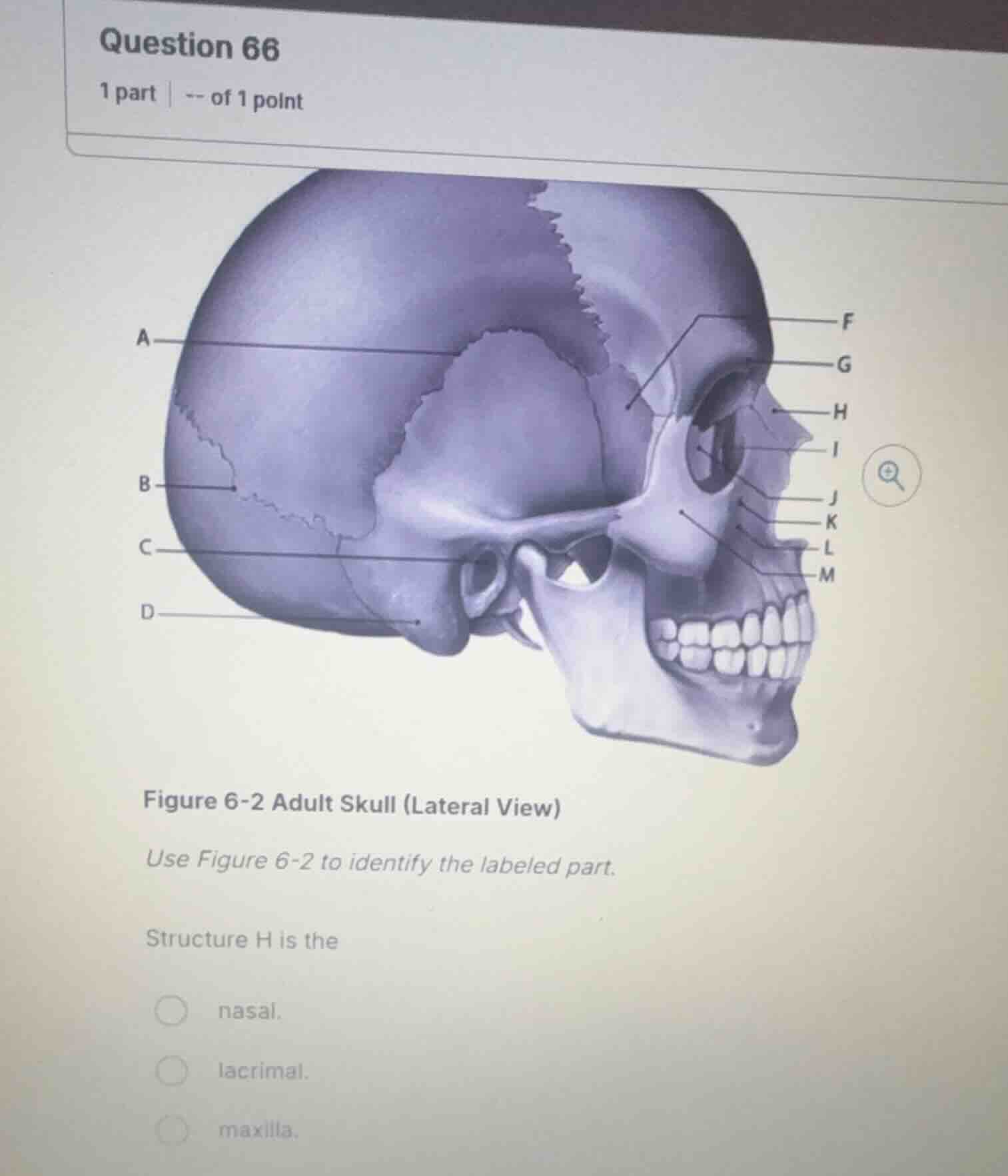 question 66 1 part | -- of 1 point figure 6-2 adult skull (lateral view…