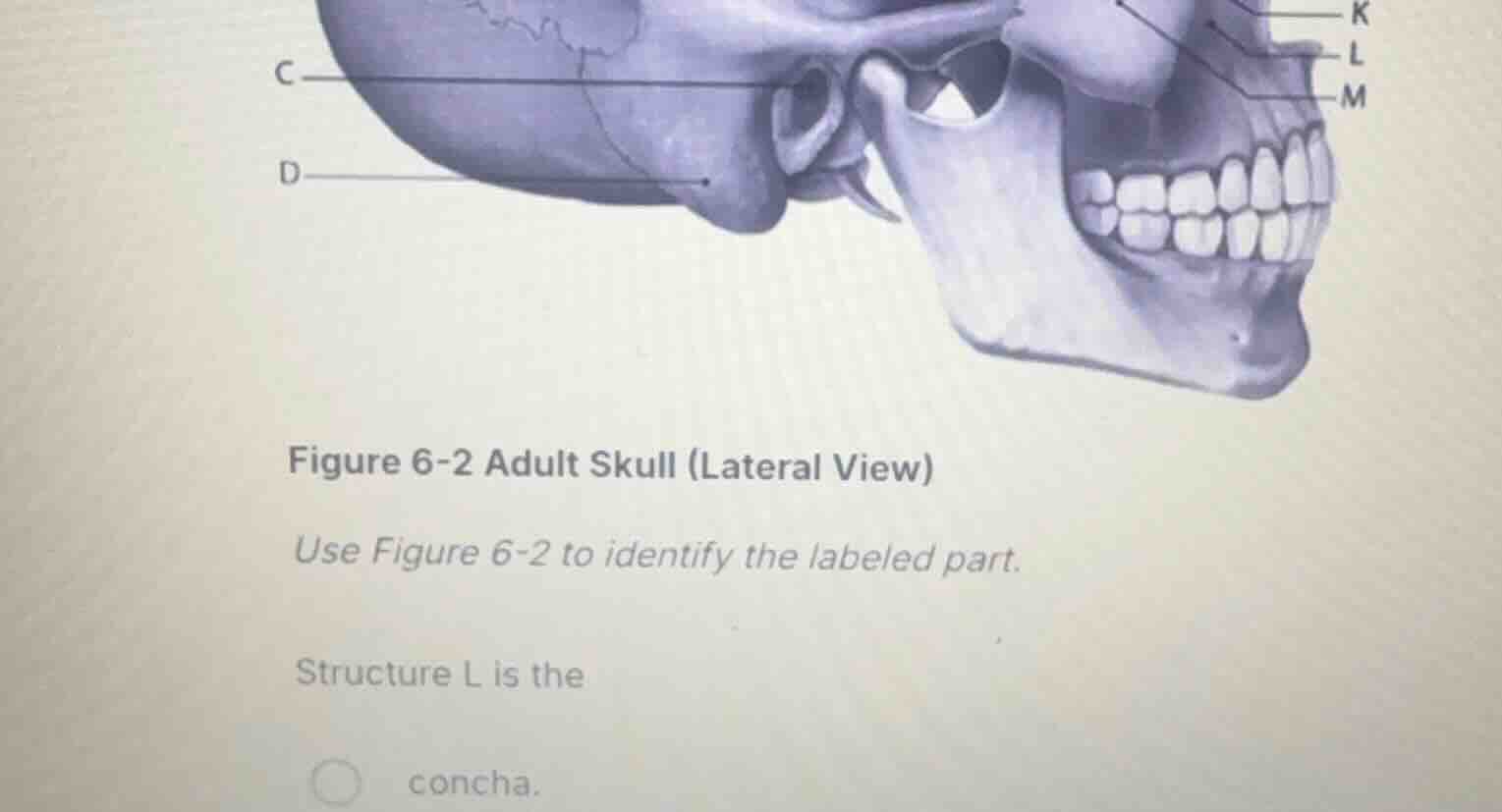 figure 6-2 adult skull (lateral view) use figure 6-2 to identify the la…