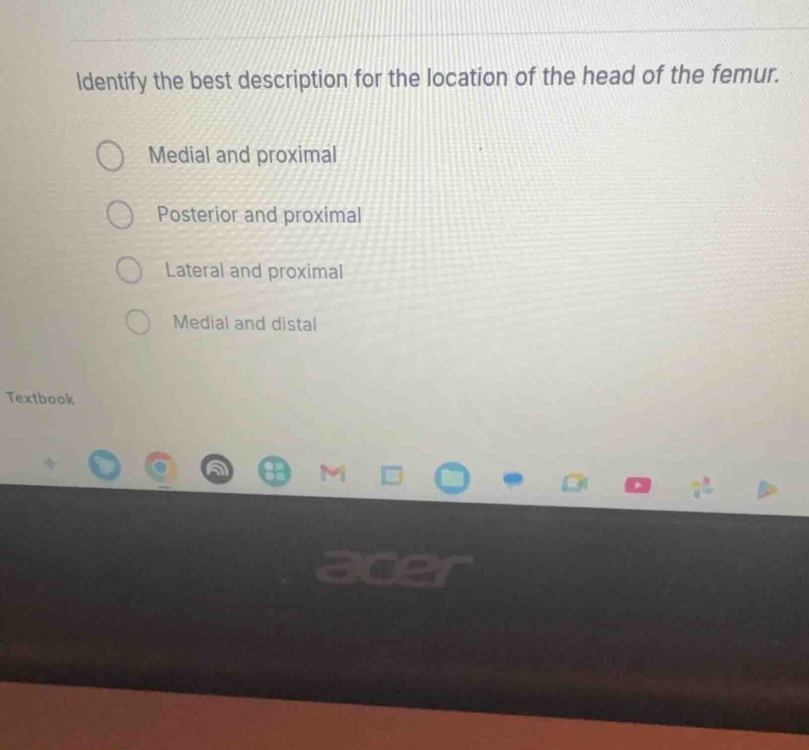 identify the best description for the location of the head of the femur…