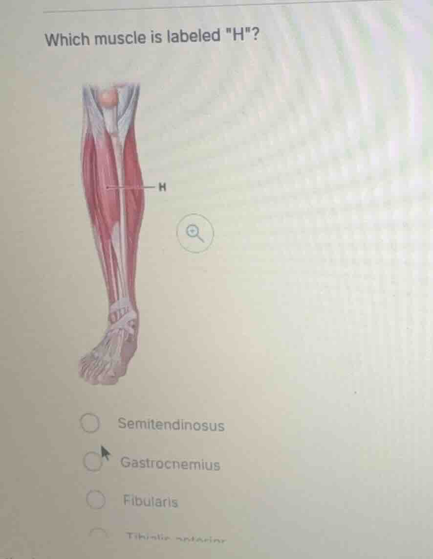 which muscle is labeled \h\? semitendinosus gastrocnemius fibularis tib…