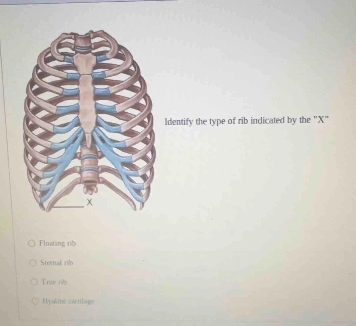 identify the type of rib indicated by the \x\○ floating rib○ sternal ri…