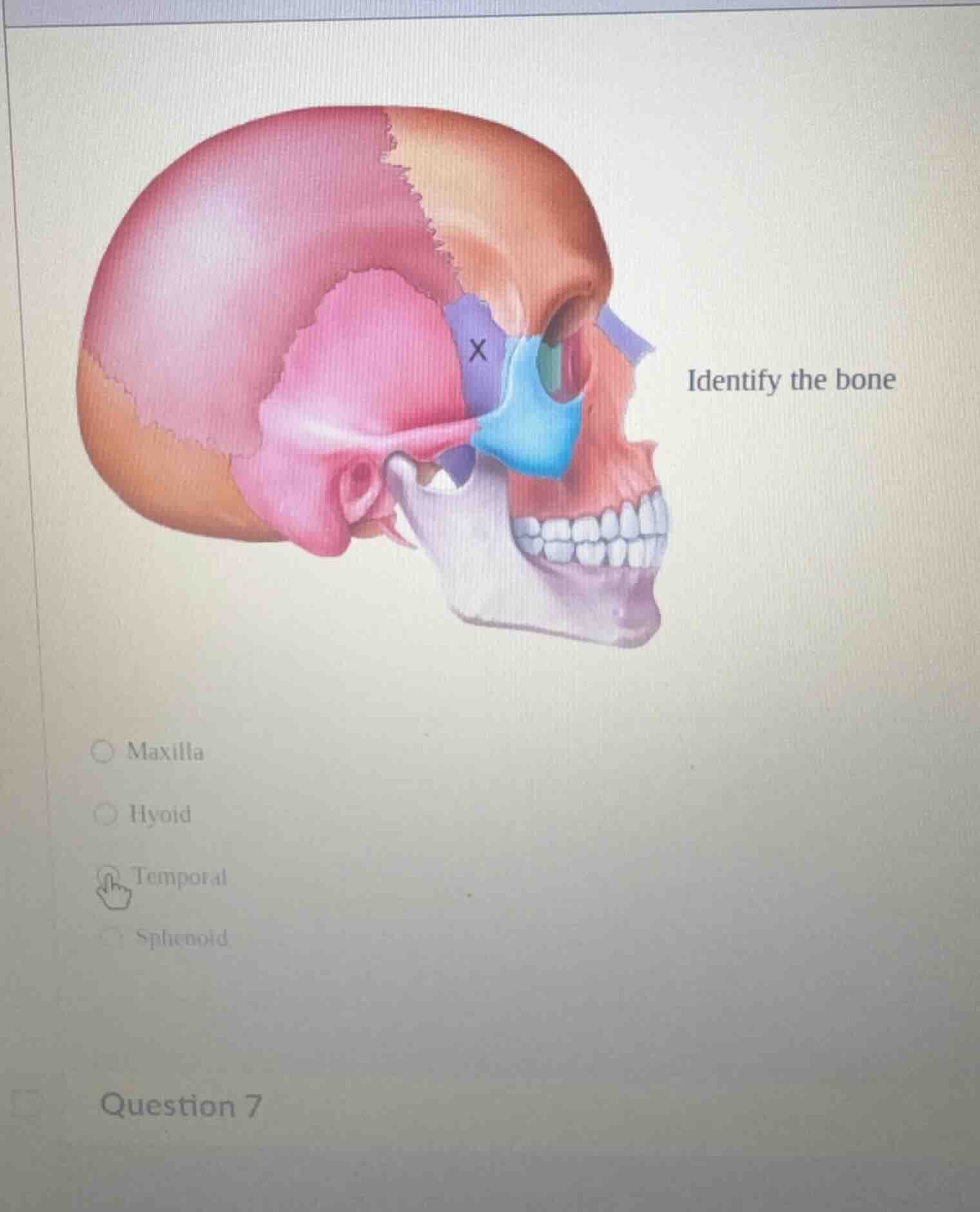 identify the bone ○ maxilla ○ hyoid ○ temporal ○ sphenoid question 7