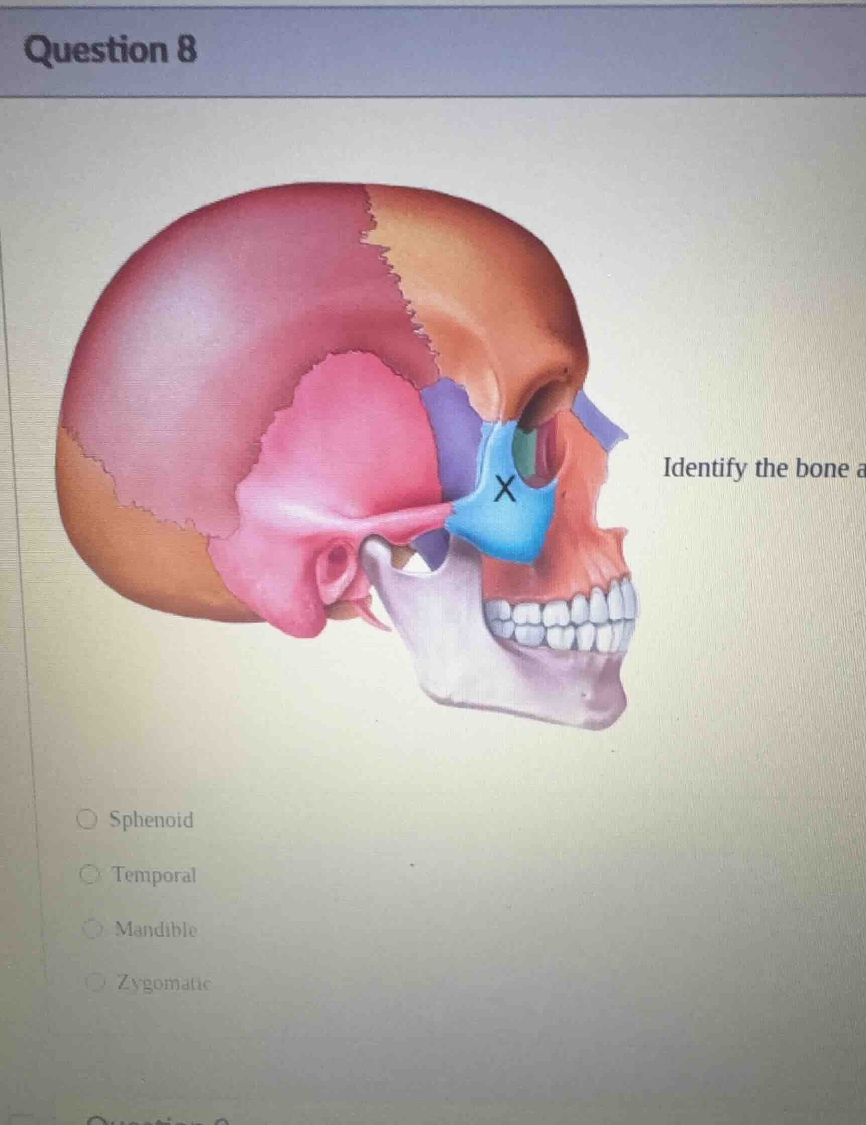 question 8 identify the bone a ○ sphenoid ○ temporal ○ mandible ○ zygom…
