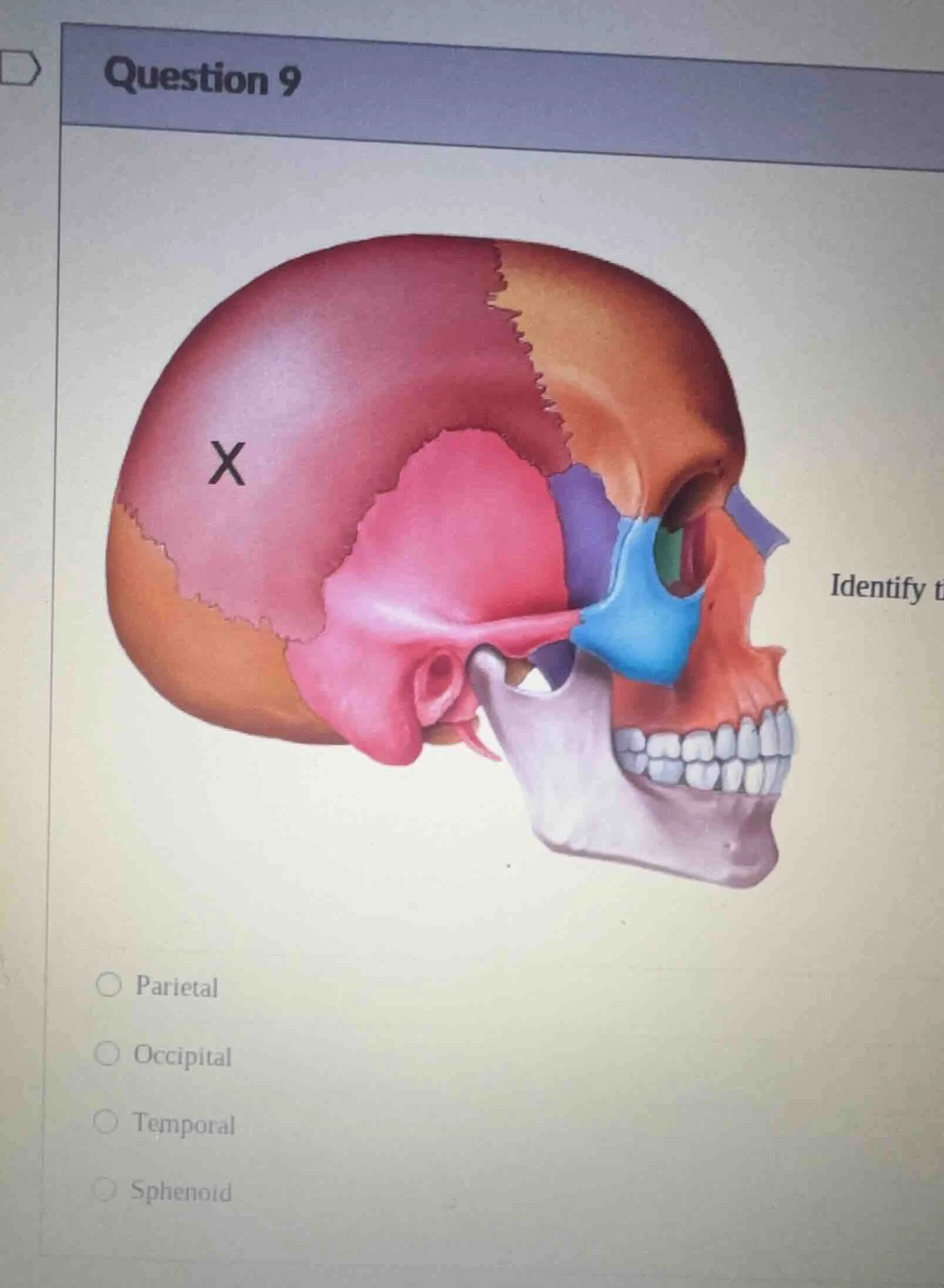 question 9 identify t ○ parietal ○ occipital ○ temporal ○ sphenoid