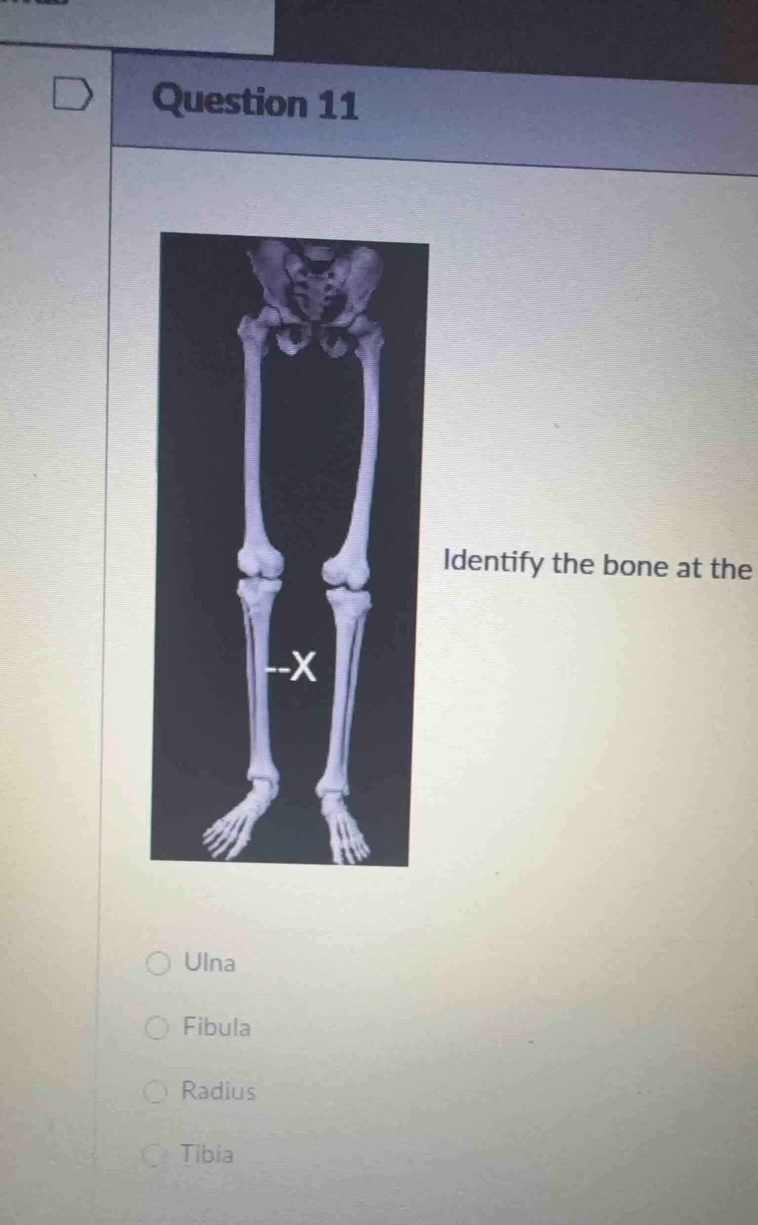 question 11 identify the bone at the ulna fibula radius tibia