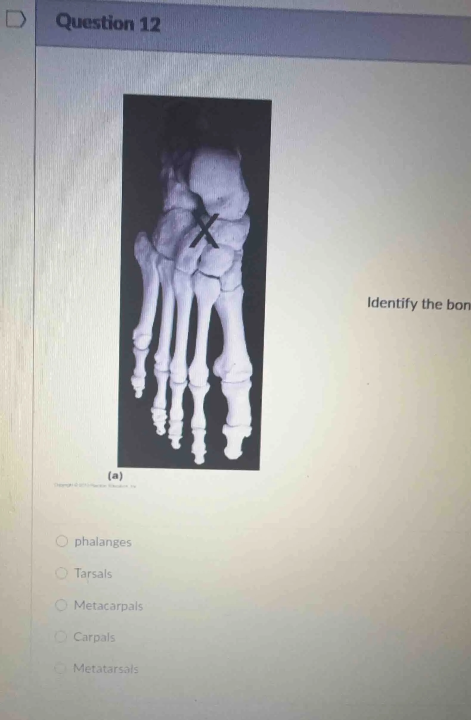 question 12 identify the bon (a) ○ phalanges ○ tarsals ○ metacarpals ○ …