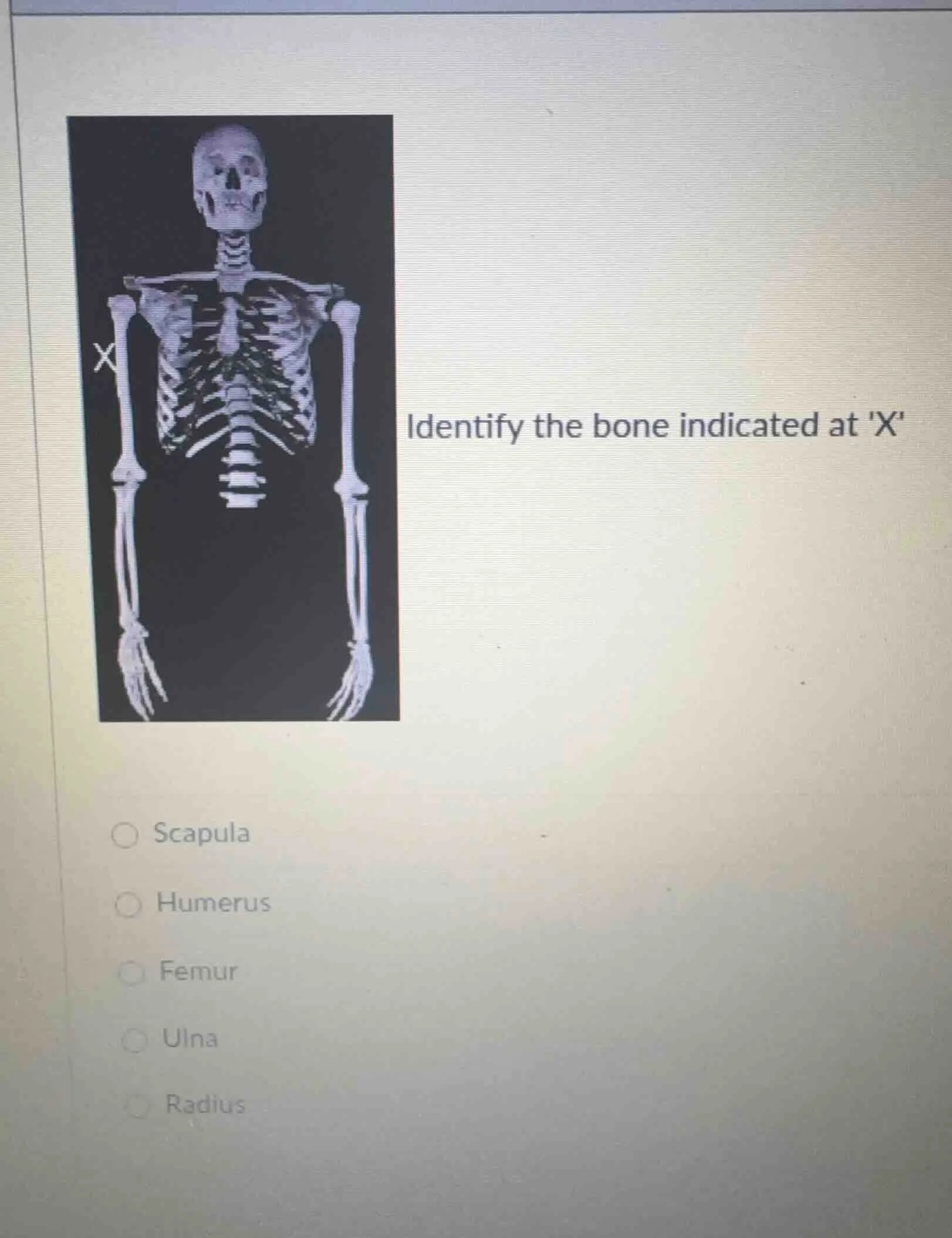 identify the bone indicated at x scapula humerus femur ulna radius