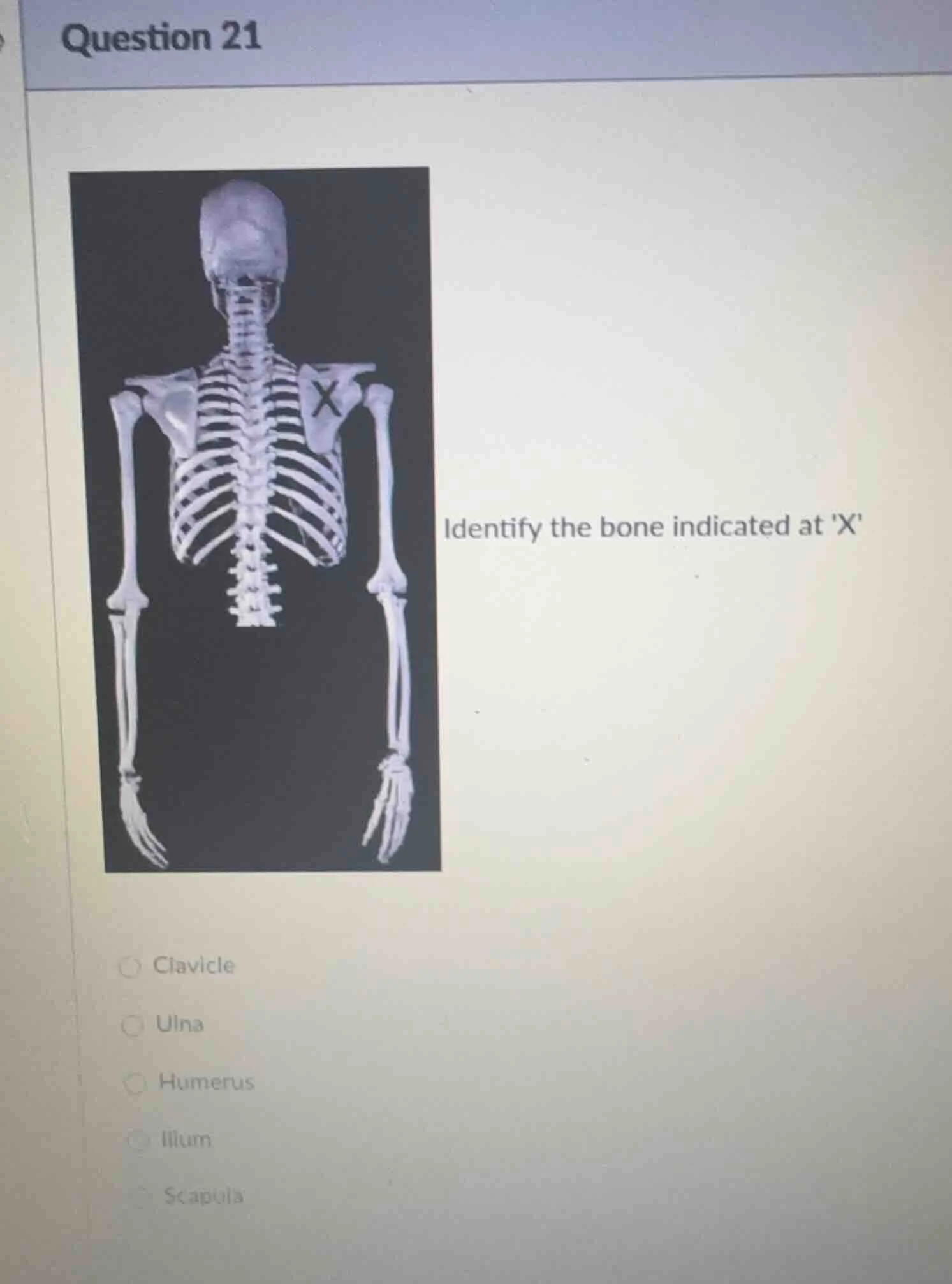 question 21 identify the bone indicated at x clavicle ulna humerus illu…