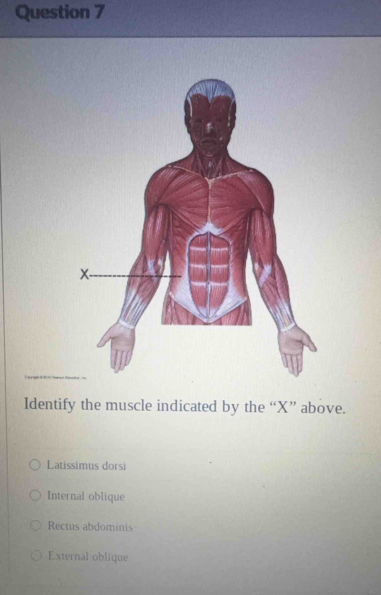 question 7 identify the muscle indicated by the \x\ above. ○ latissimus…
