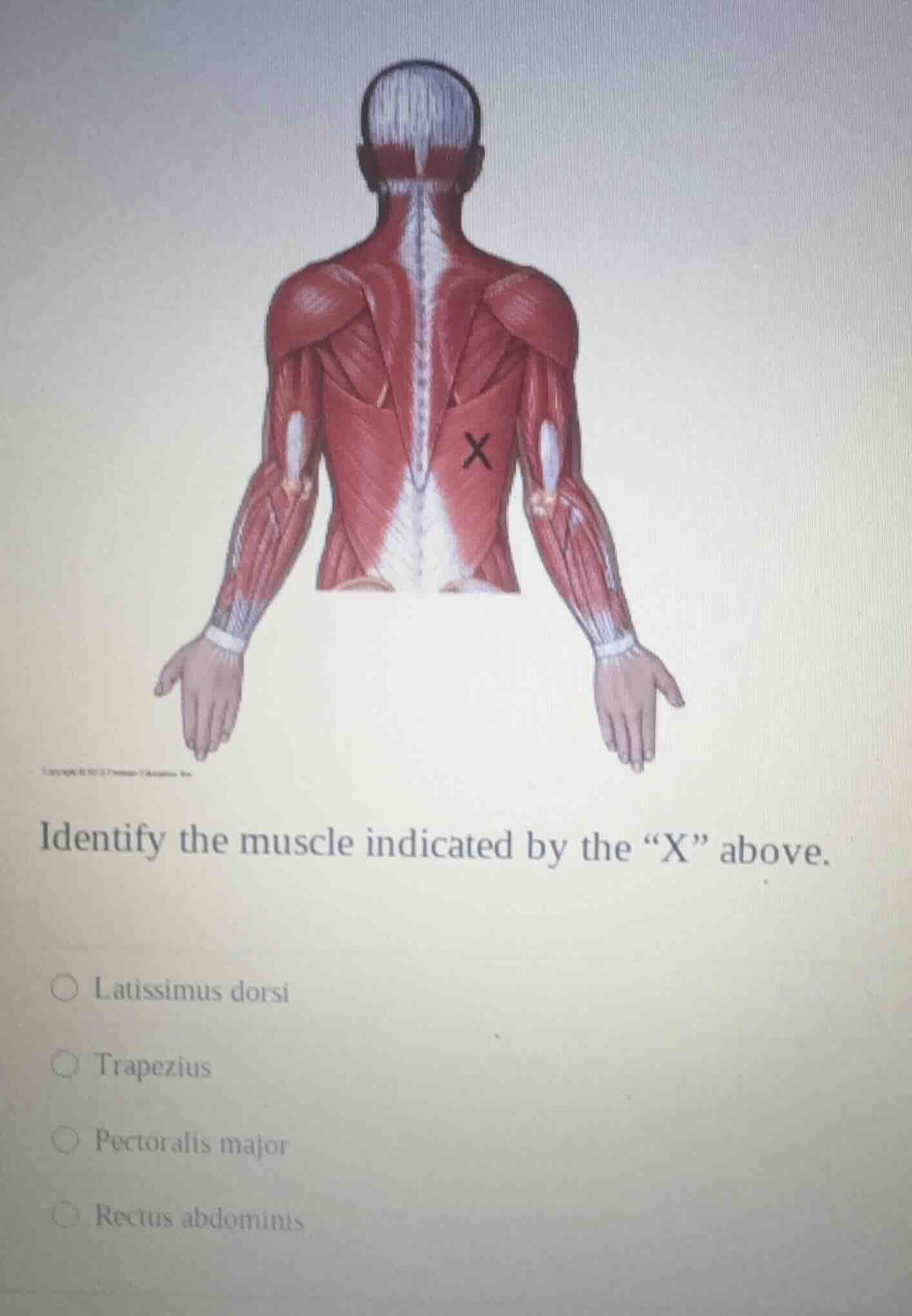 identify the muscle indicated by the “x” above. ○ latissimus dorsi ○ tr…