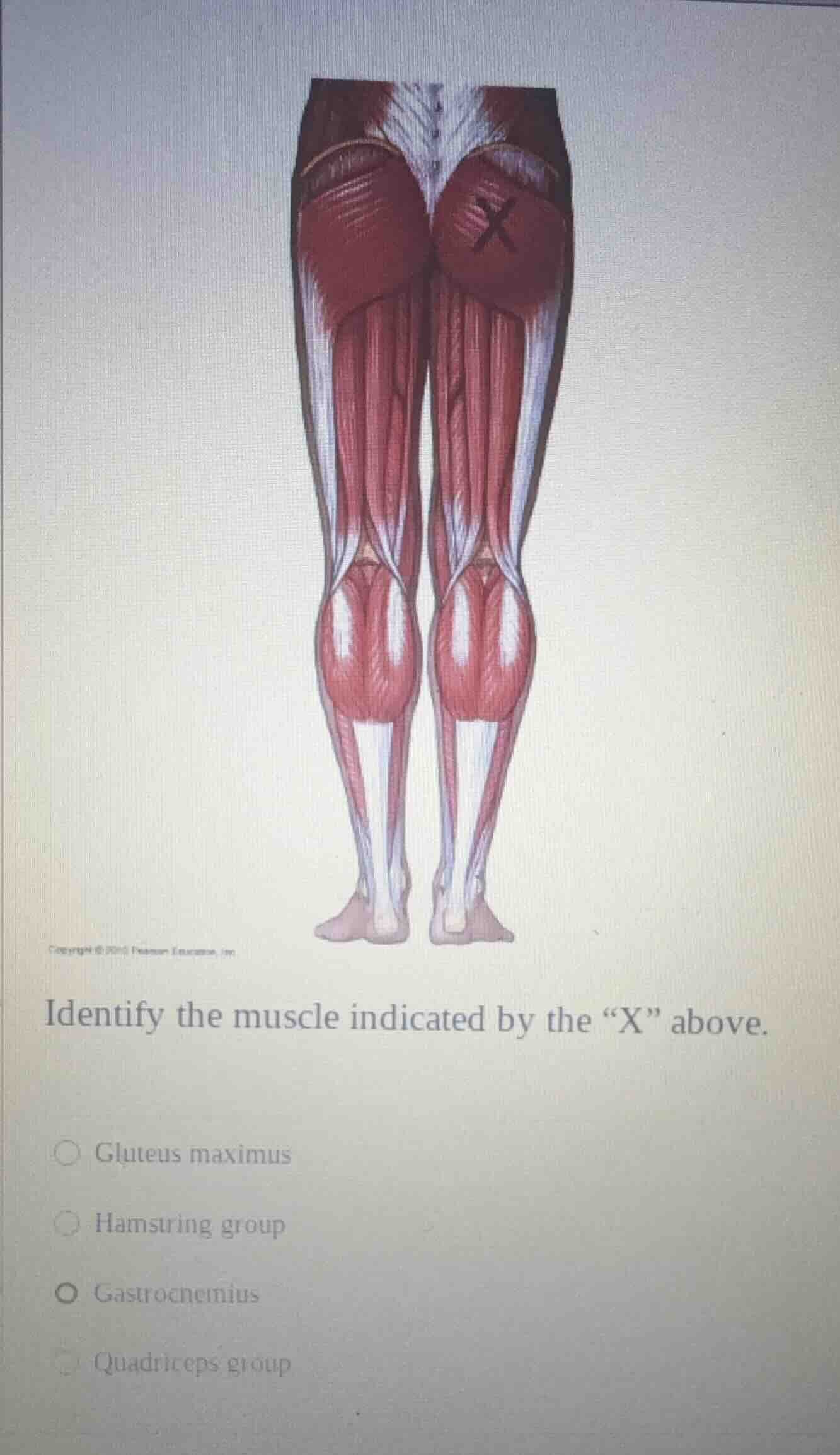 identify the muscle indicated by the “x” above.○ gluteus maximus○ hamst…