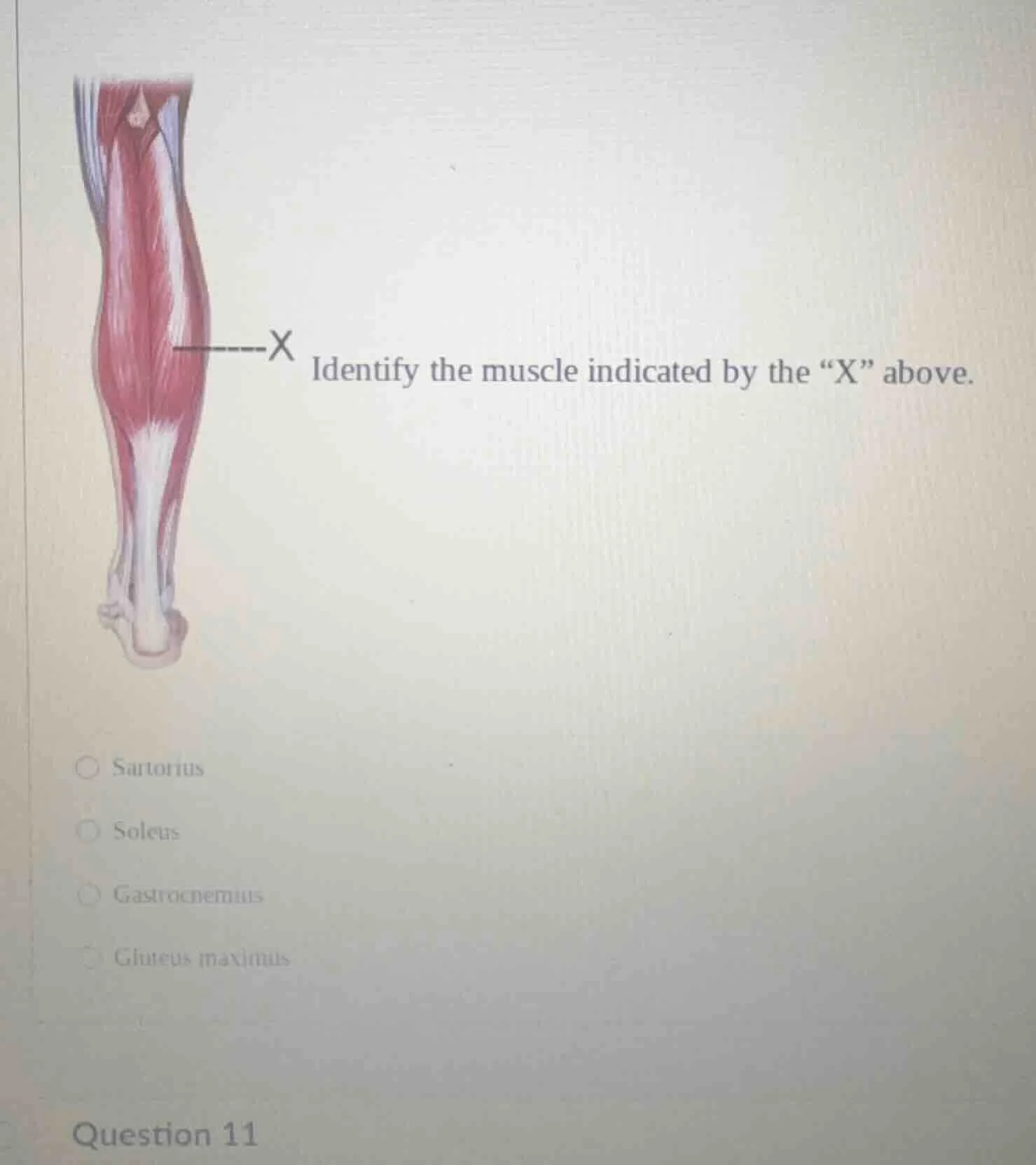 identify the muscle indicated by the “x” above. ○ sartorius ○ soleus ○ …