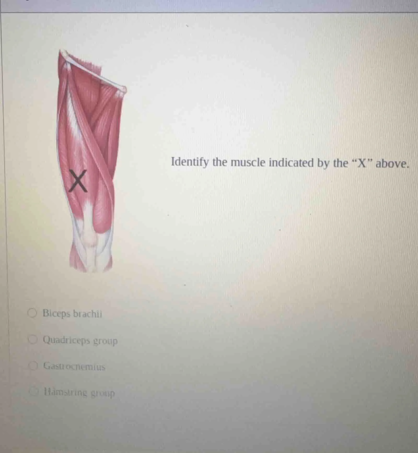 identify the muscle indicated by the “x” above.○ biceps brachii○ quadri…