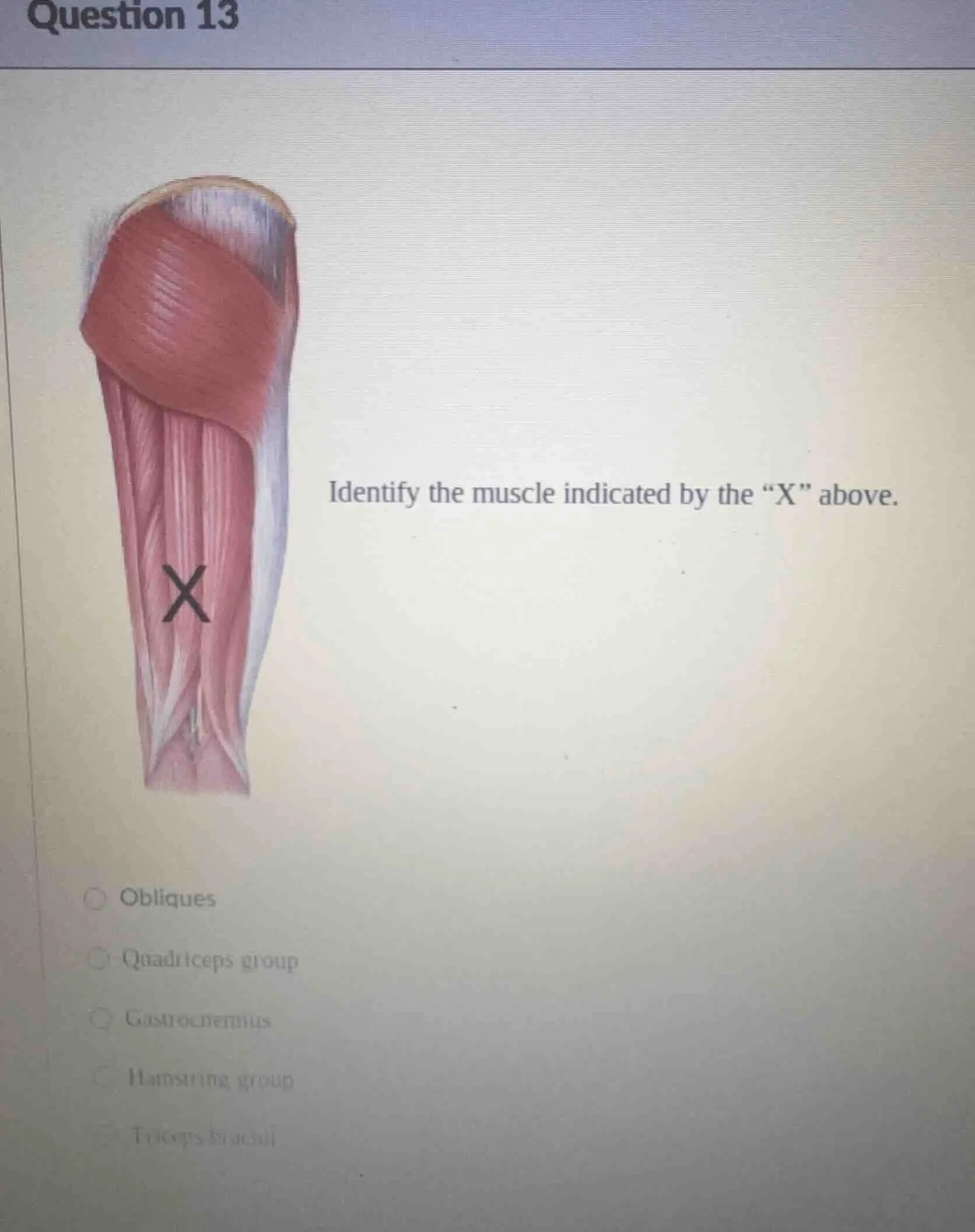 question 13 identify the muscle indicated by the \x\ above. obliques qu…